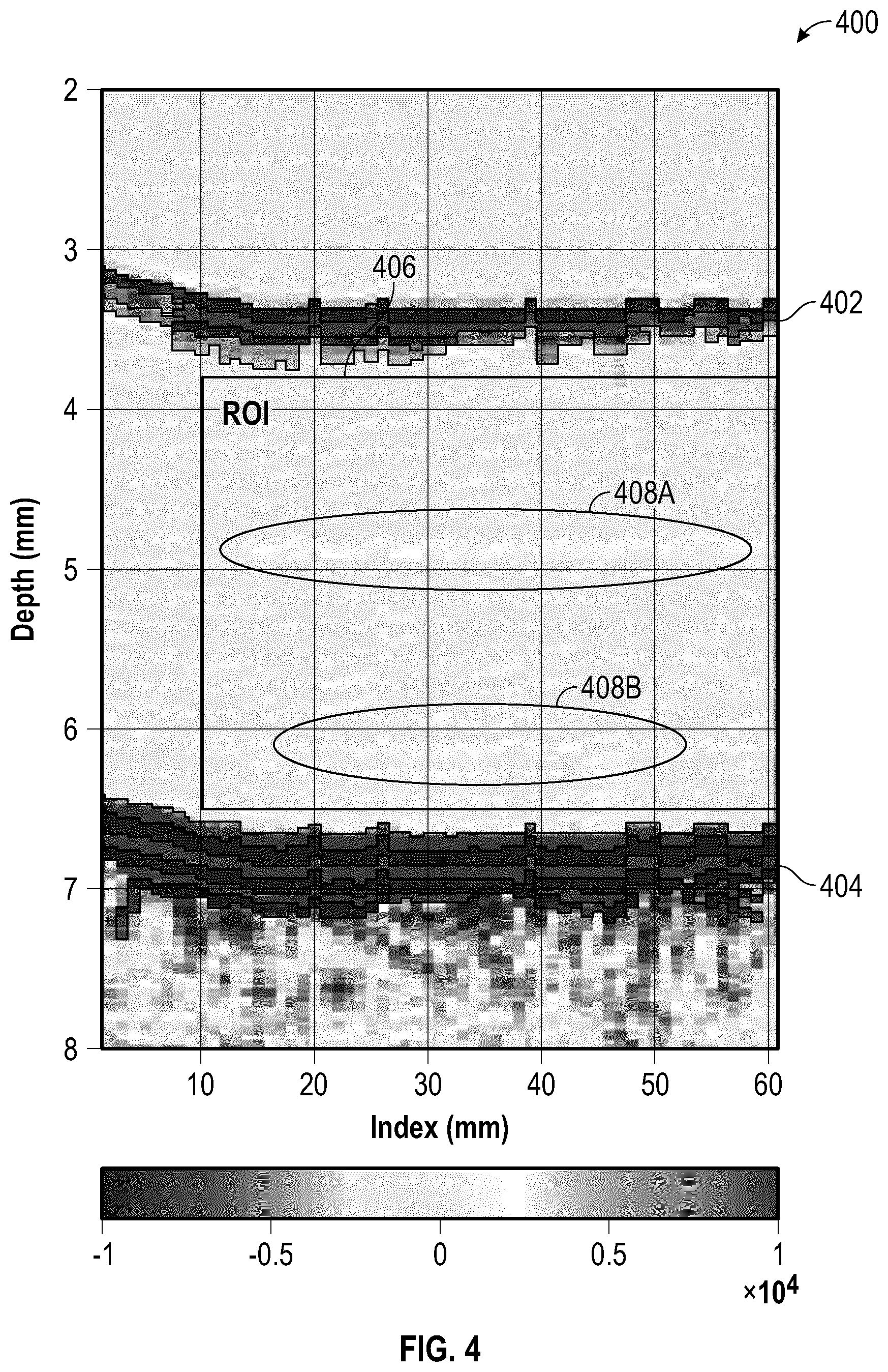 Patent US12618809 Figure 4 – Probe position encoding by ultrasound image correlation