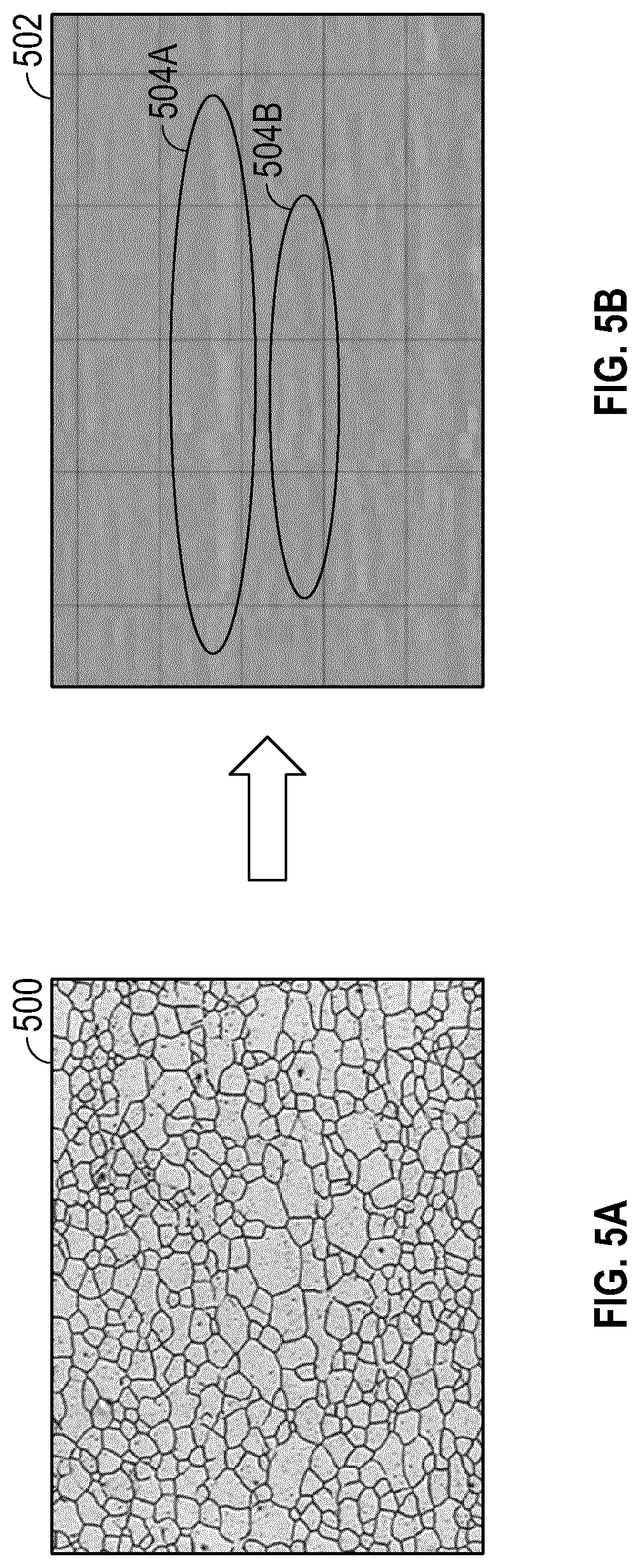 Patent US12618809 Figure 5 – Probe position encoding by ultrasound image correlation