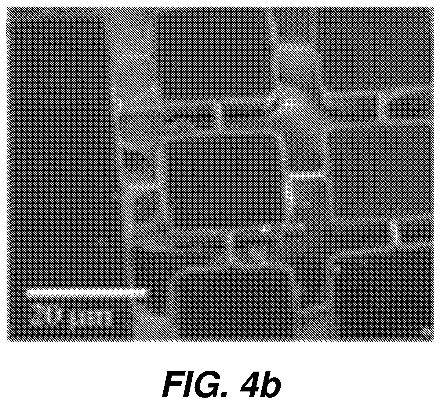 Patent US12618825 Figure 15 – Biological sensing system having micro-electrode array