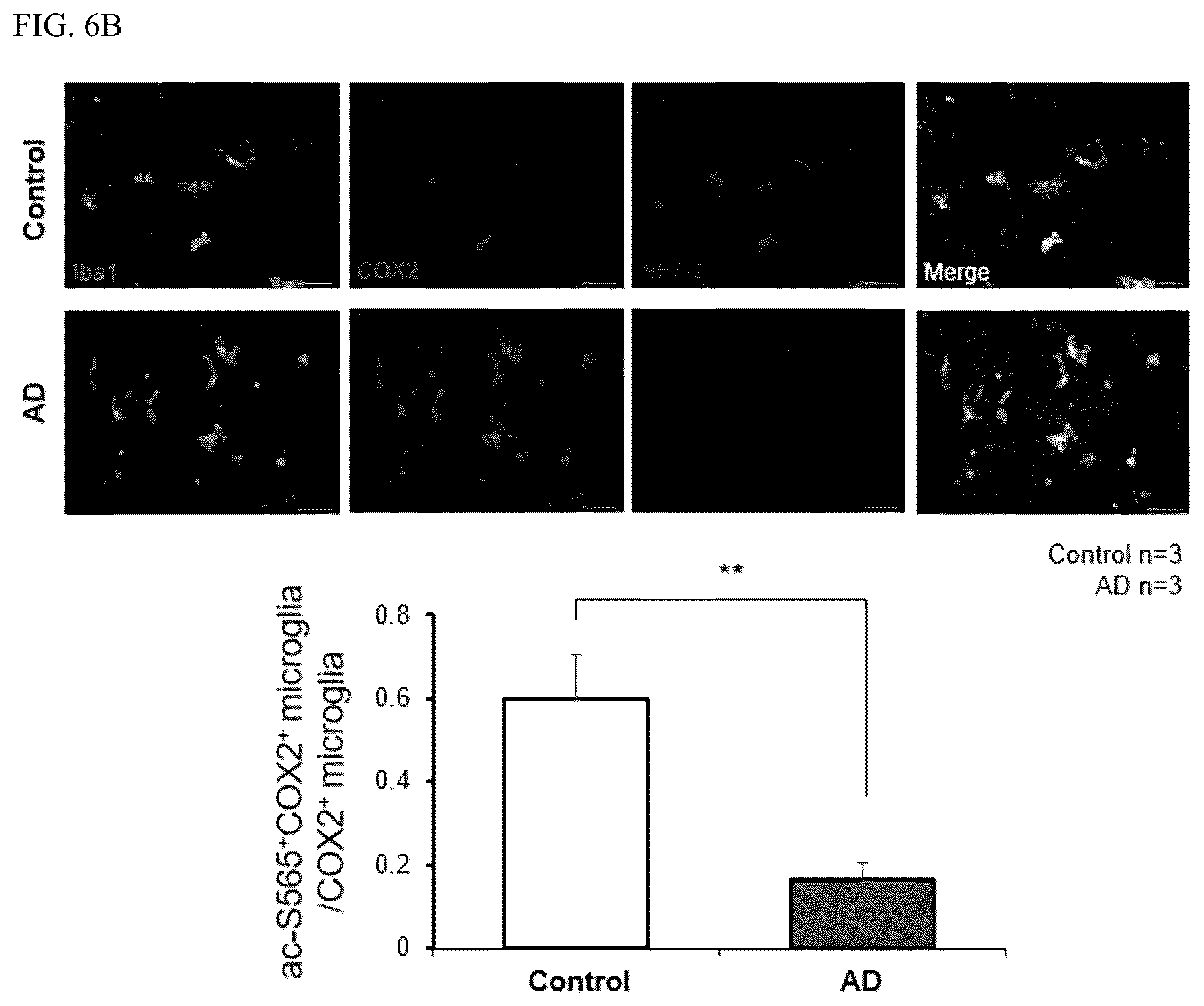 Patent US12618840 Figure 12 – Antibody for detecting acetylation of COX2 protein, and uses thereof