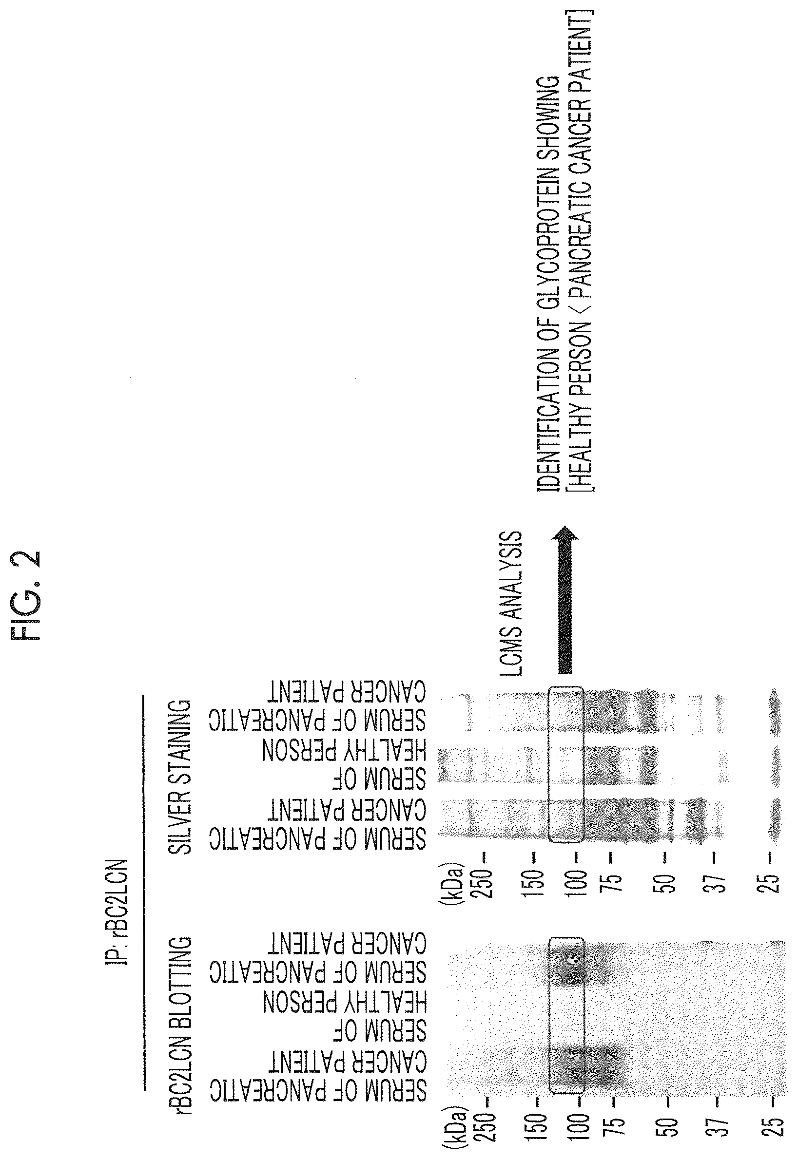 Patent US12618842 Figure 2 – Cancer test method