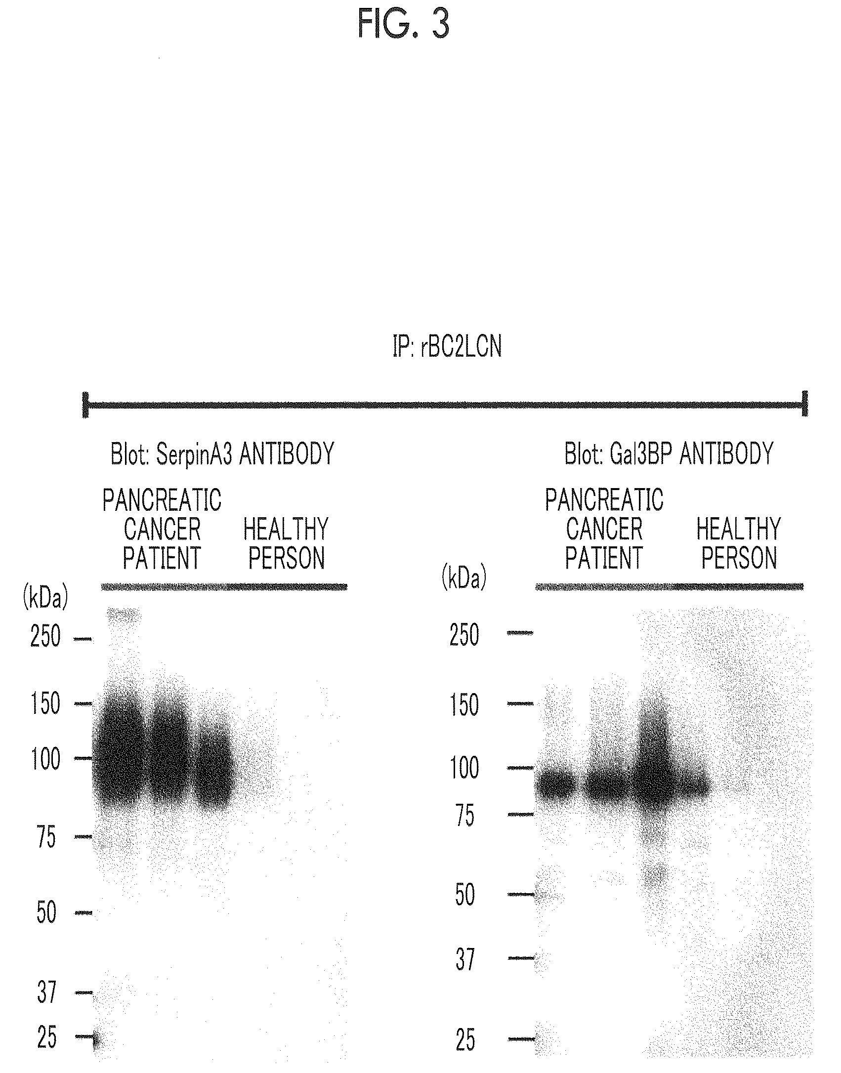 Patent US12618842 Figure 3 – Cancer test method