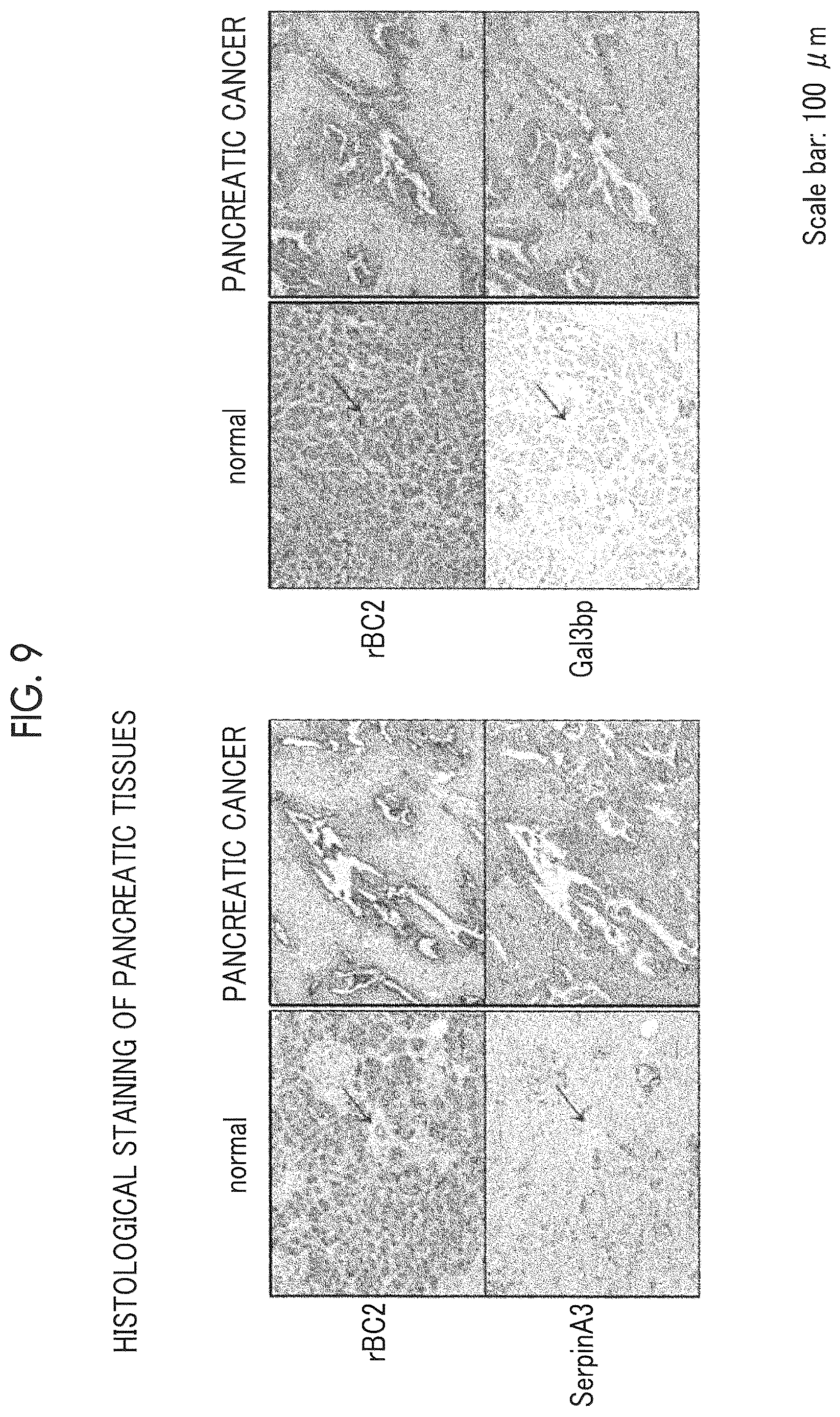 Patent US12618842 Figure 10 – Cancer test method