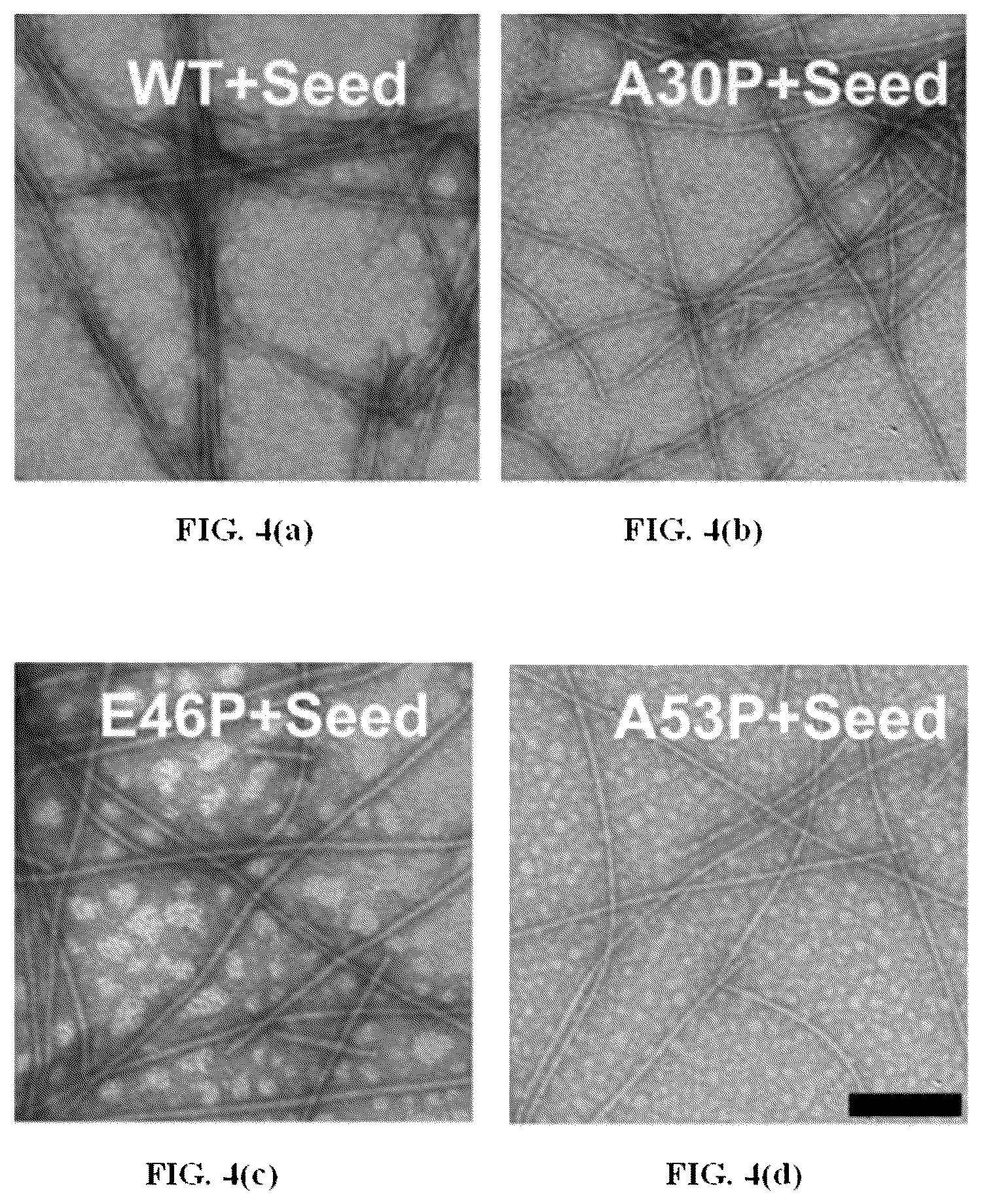 Patent US12618856 Figure 7 – Alpha-synuclein mutants and uses thereof
