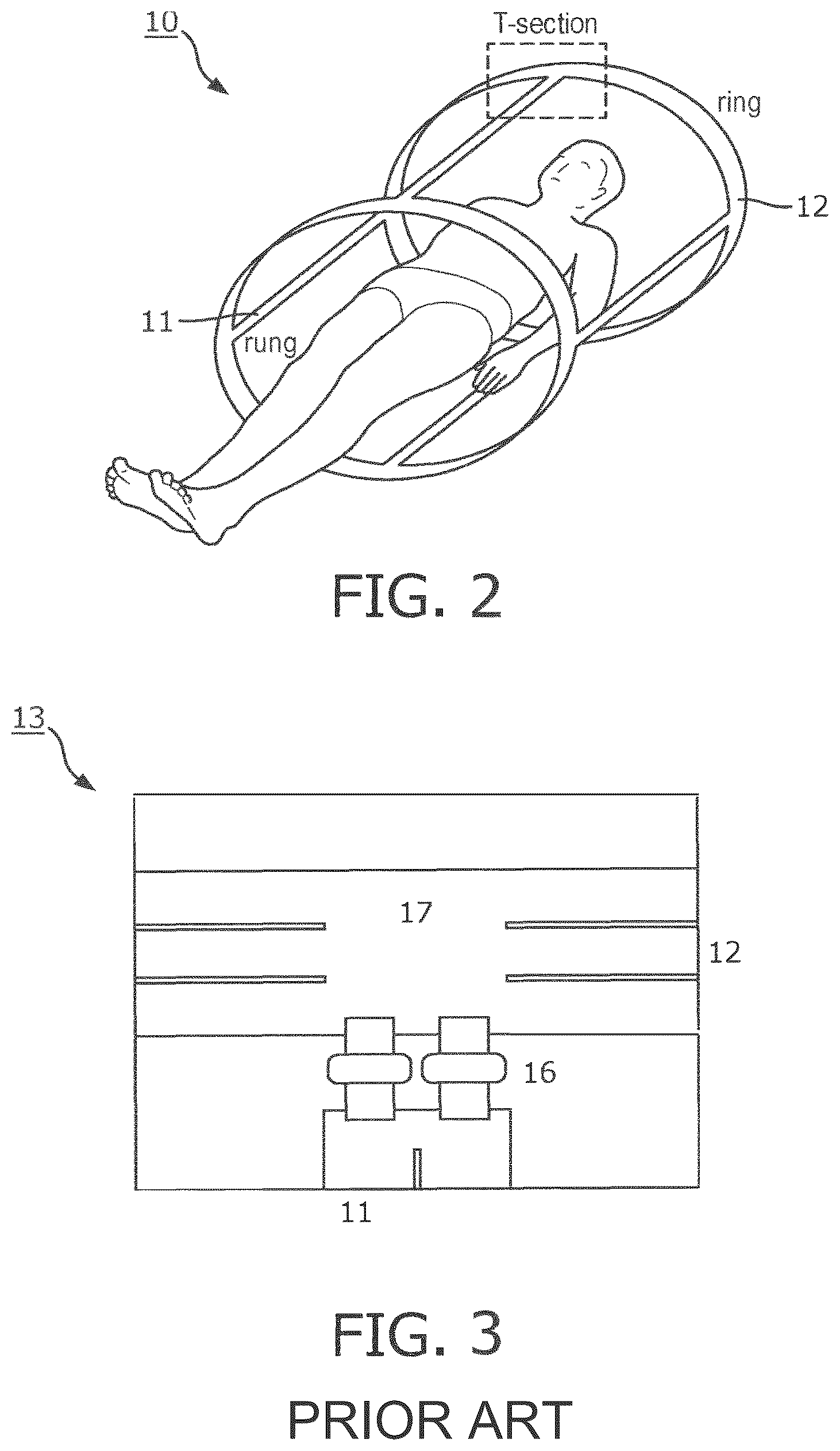 Patent US12618923 Figure 2 – Radio frequency coil with T-shaped connector between electrical conductors and radio frequency shield