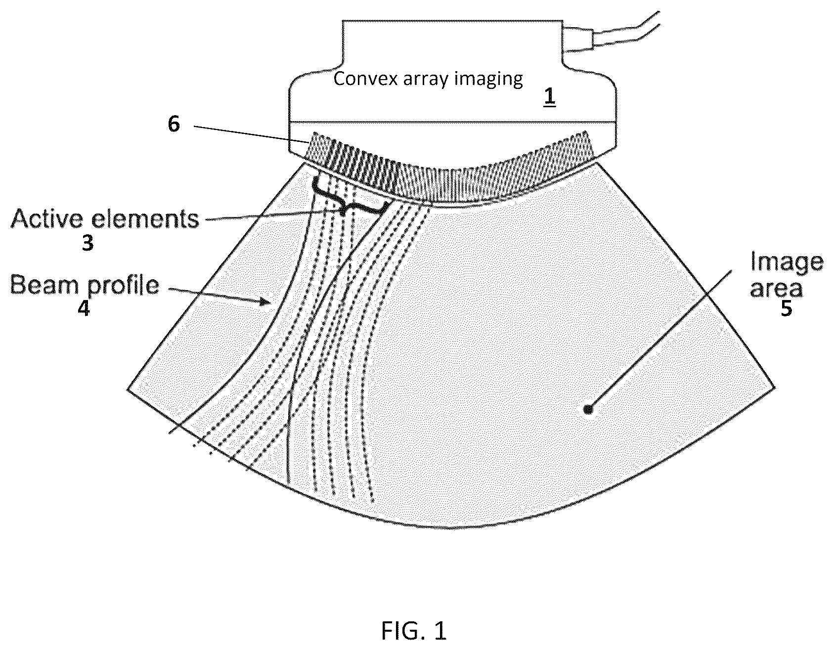 Patent US12618955 Figure 1 – Adaptive retrospective transmit beamforming (RTB) for a lowpower handheld ultrasound scanner