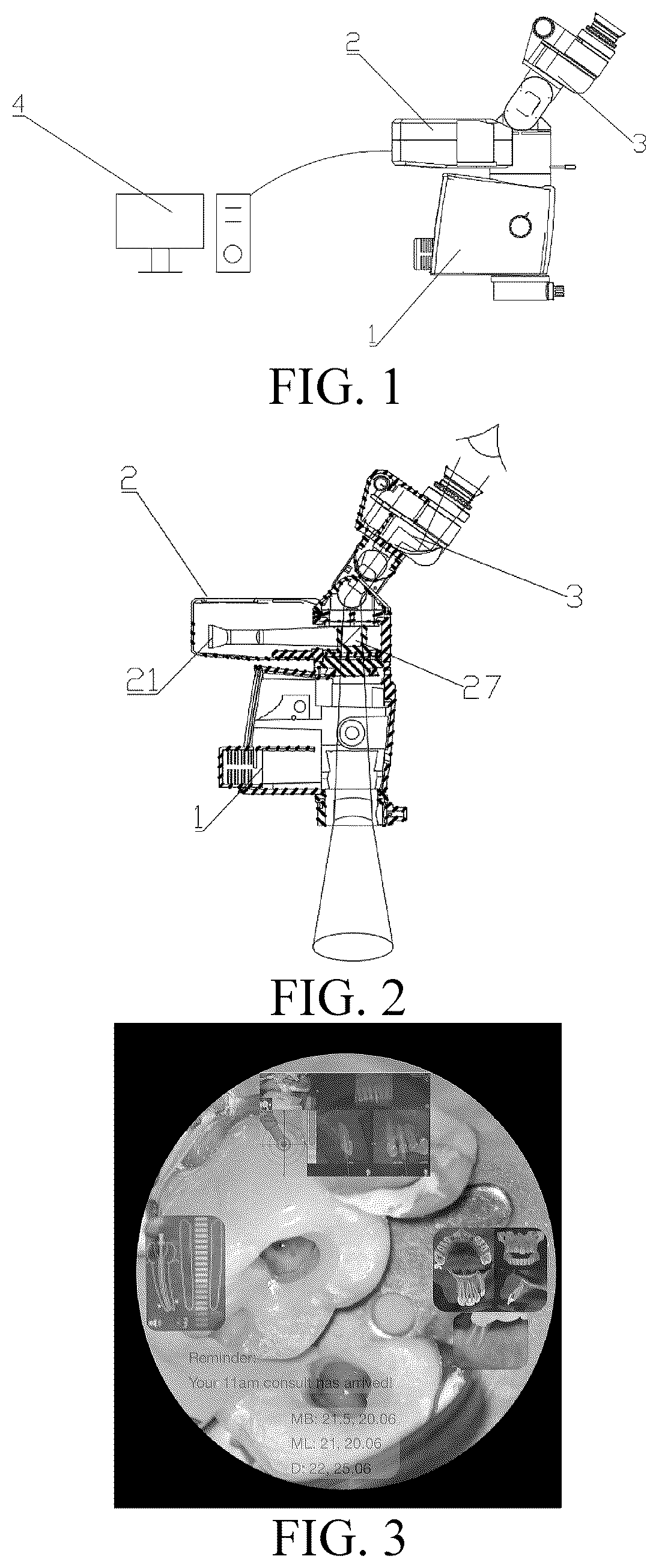 Patent US12619059 Figure 1 – Image enhancement system and implementation method therefor