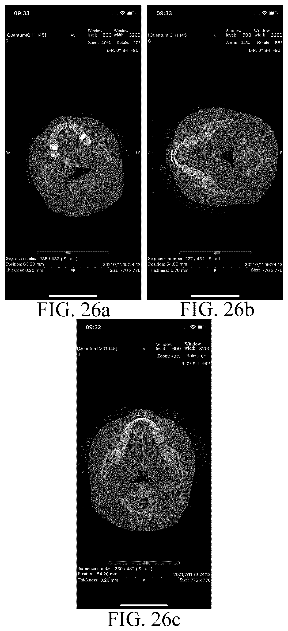 Patent US12619059 Figure 15 – Image enhancement system and implementation method therefor