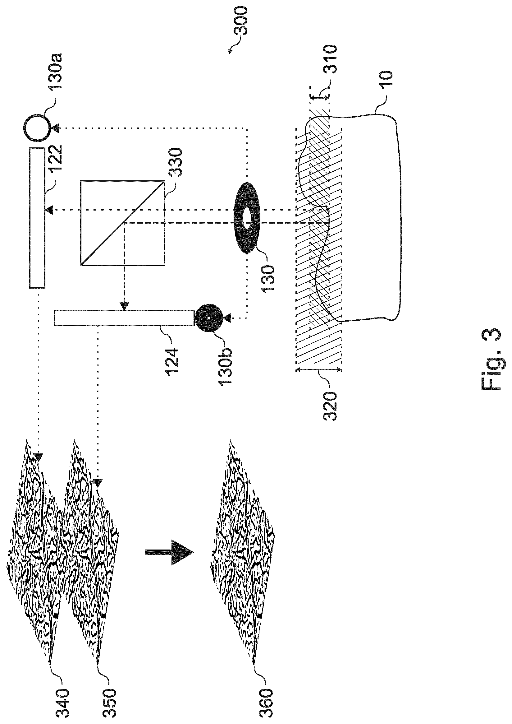 Patent US12619060 Figure 5 – Microscope system and corresponding method
