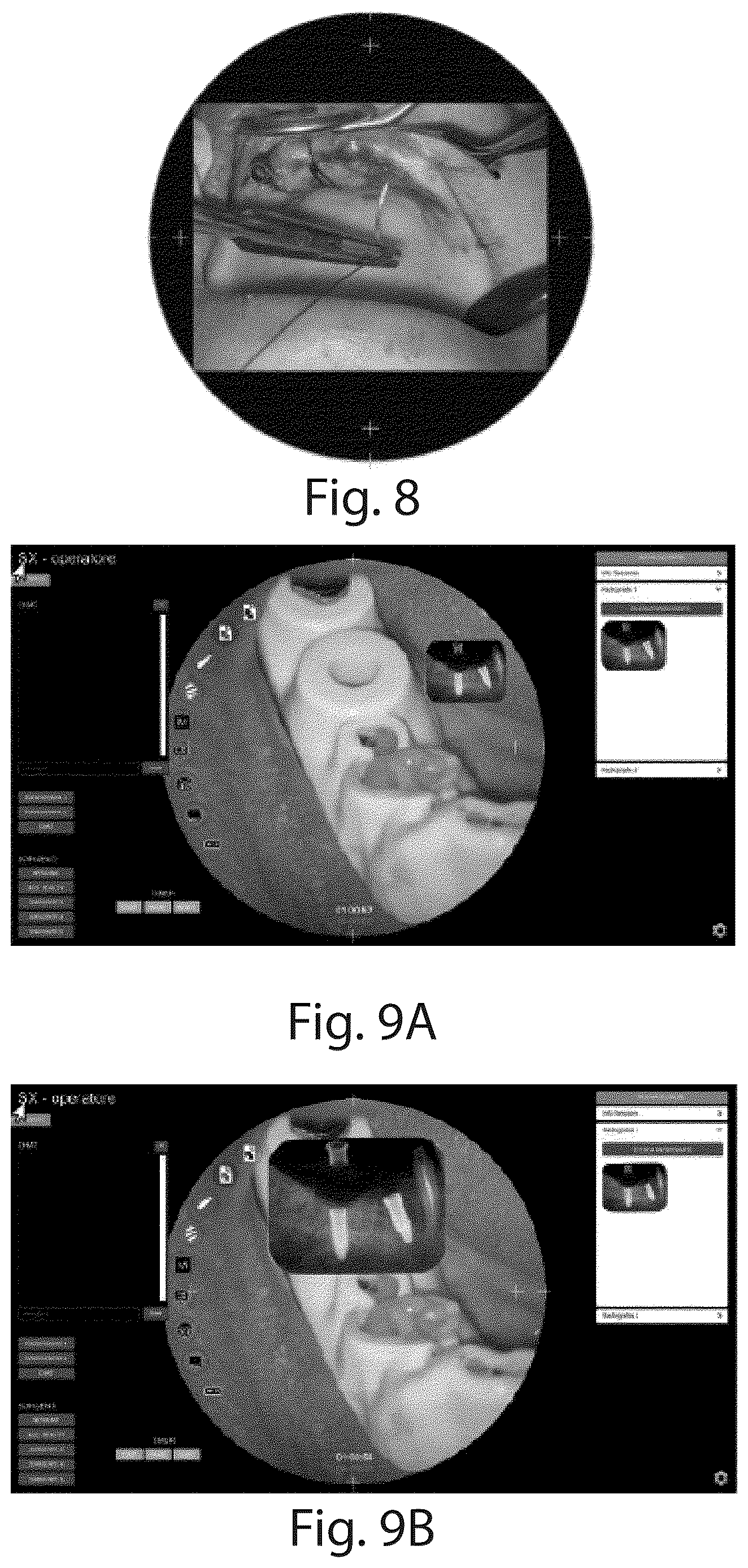 Patent US12619062 Figure 5 – Integrated optical device and related diagnostic imaging method