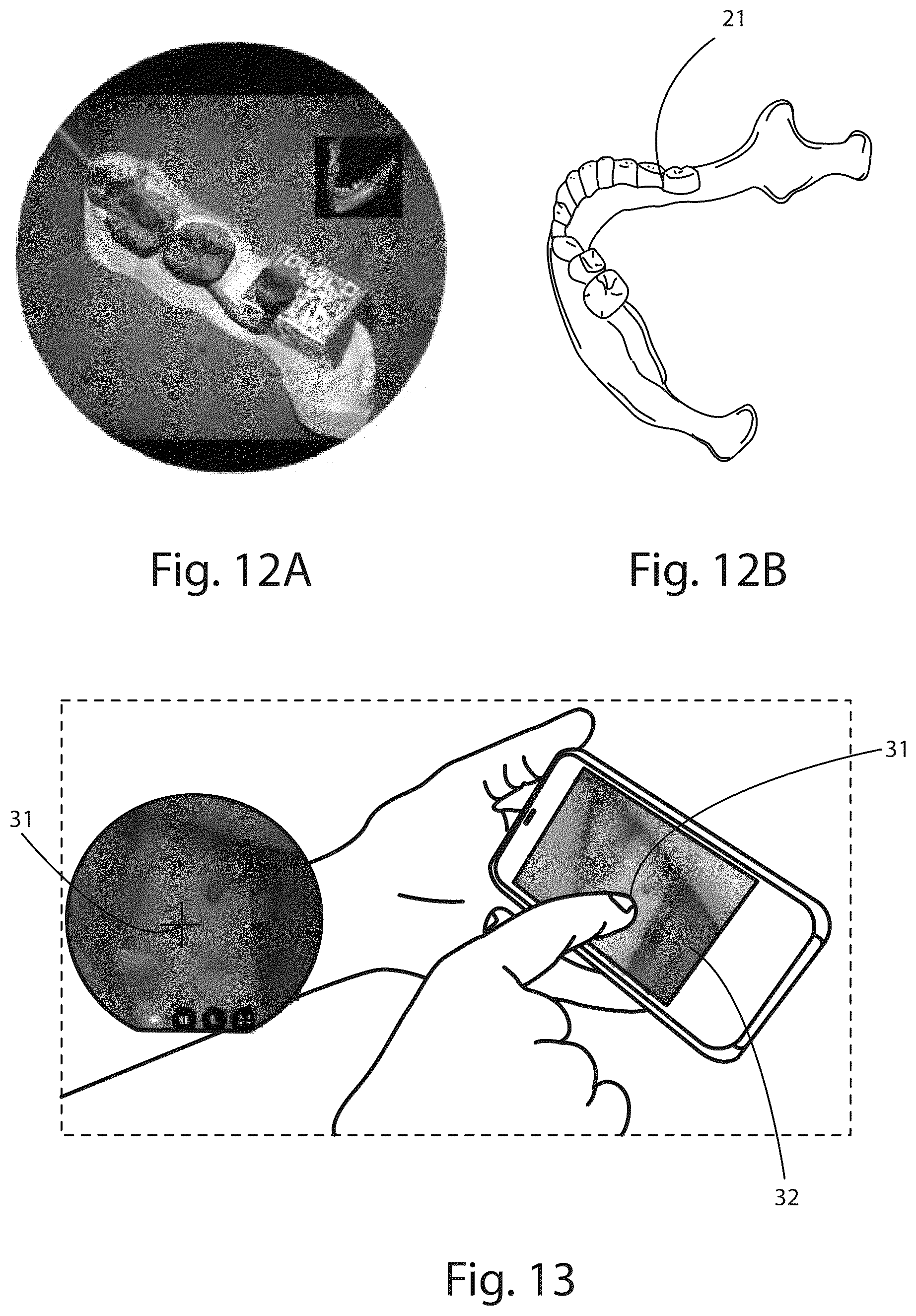 Patent US12619062 Figure 7 – Integrated optical device and related diagnostic imaging method