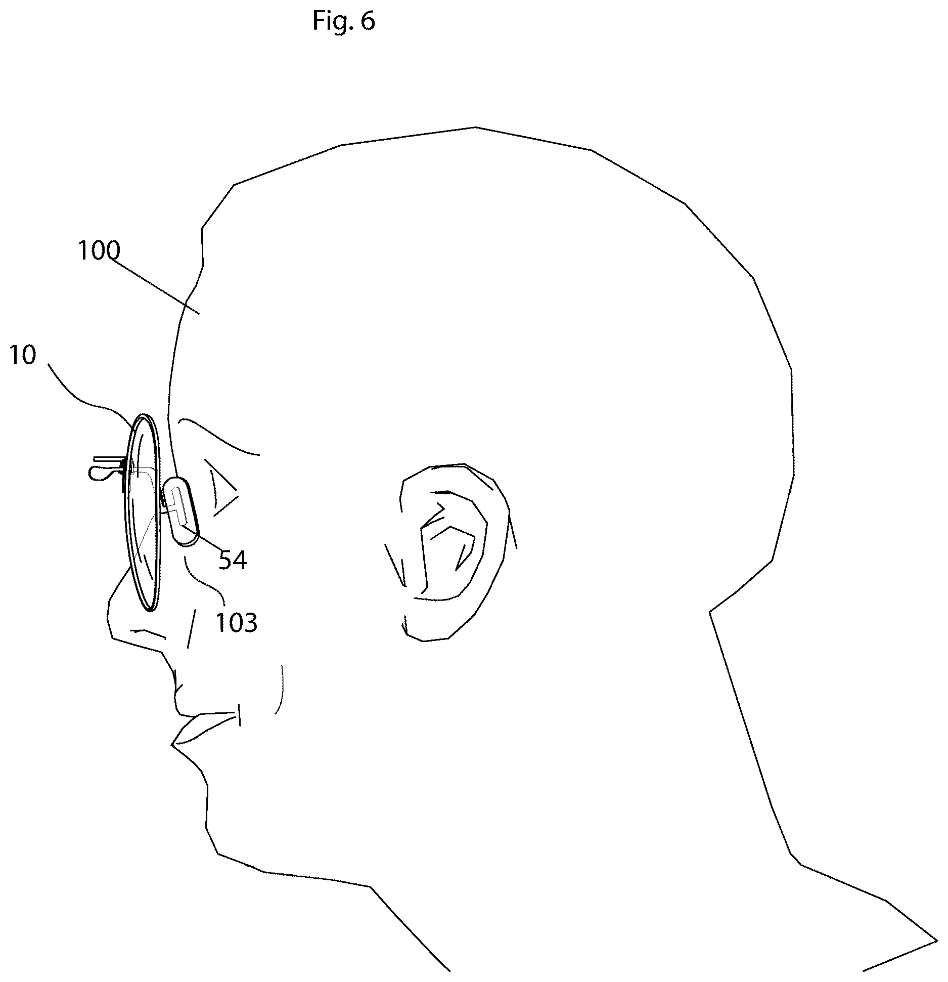 Patent US12619098 Figure 6 – Eyeglasses retention mechanism