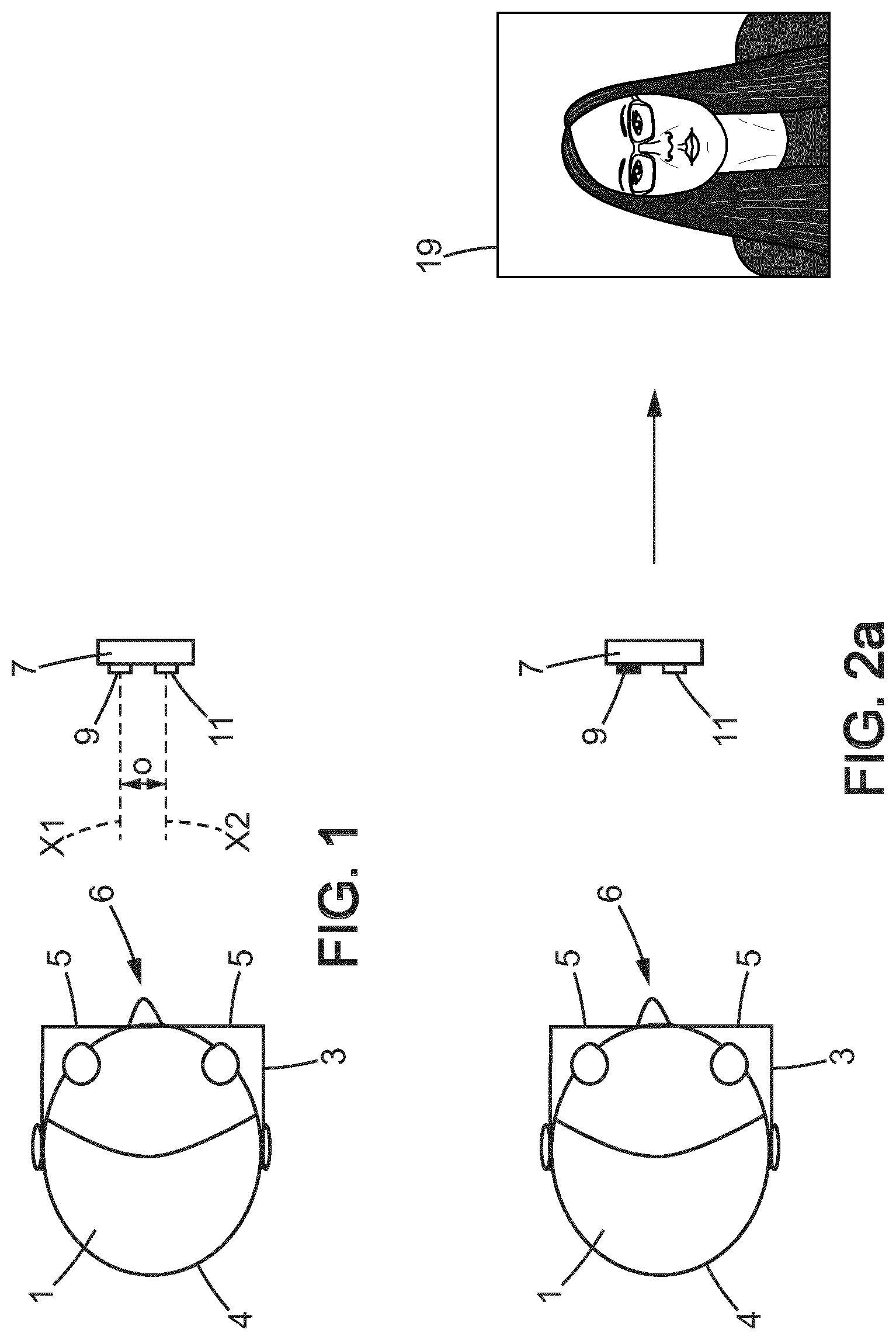Patent US12619107 Figure 1 – Photography and thermography combining method of obtaining a fitting parameter to fit an ophthalmic lens into a spectacle frame