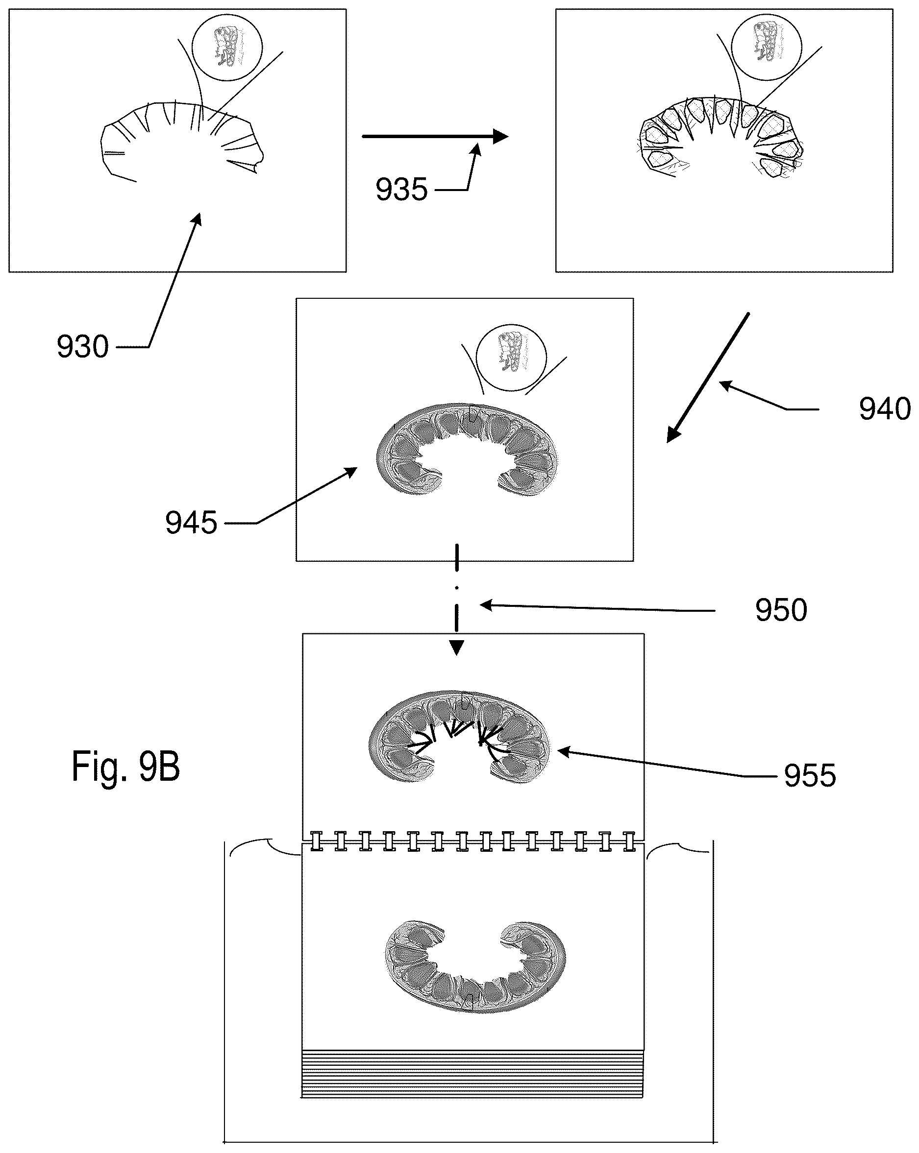 Patent US12619211 Figure 11 – Method and apparatus for a tissue engineering system utilizing stacked layers