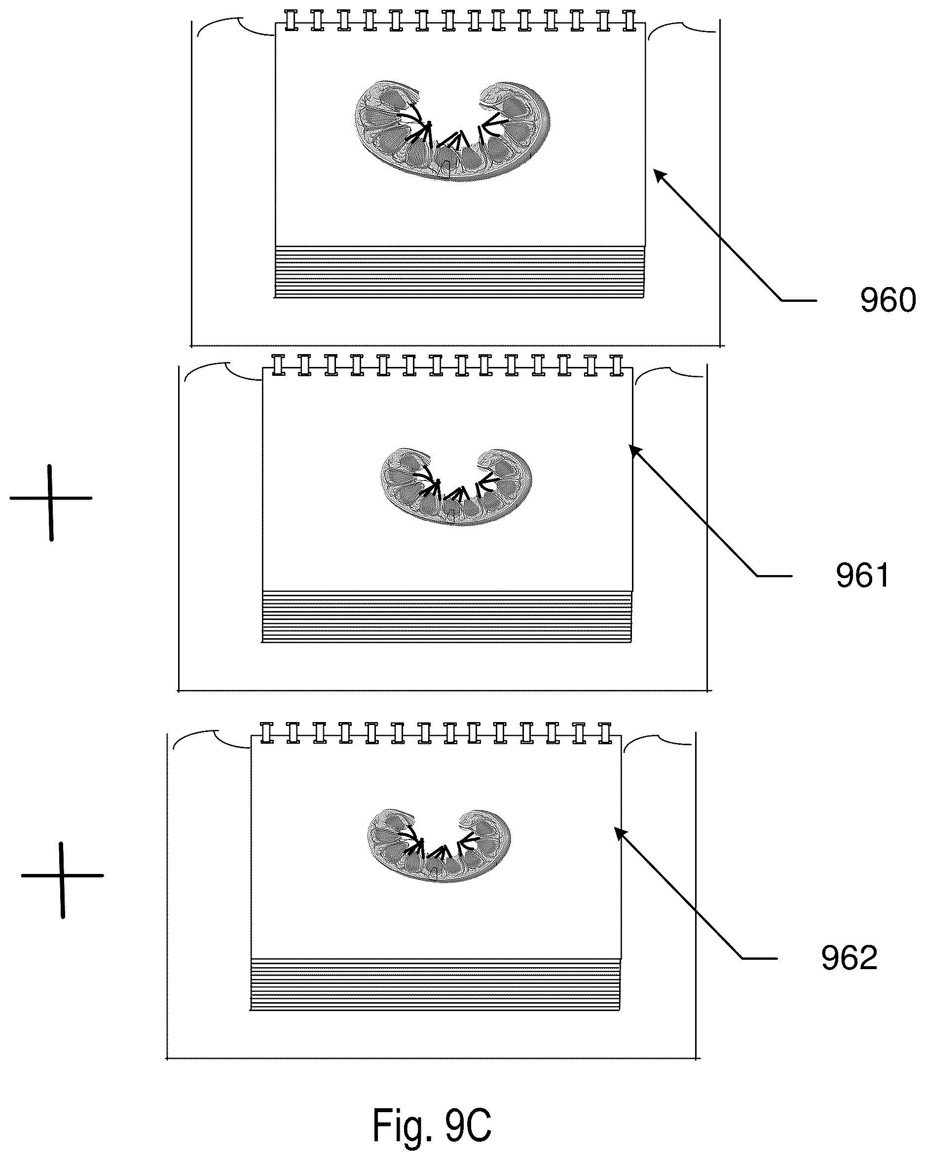 Patent US12619211 Figure 12 – Method and apparatus for a tissue engineering system utilizing stacked layers