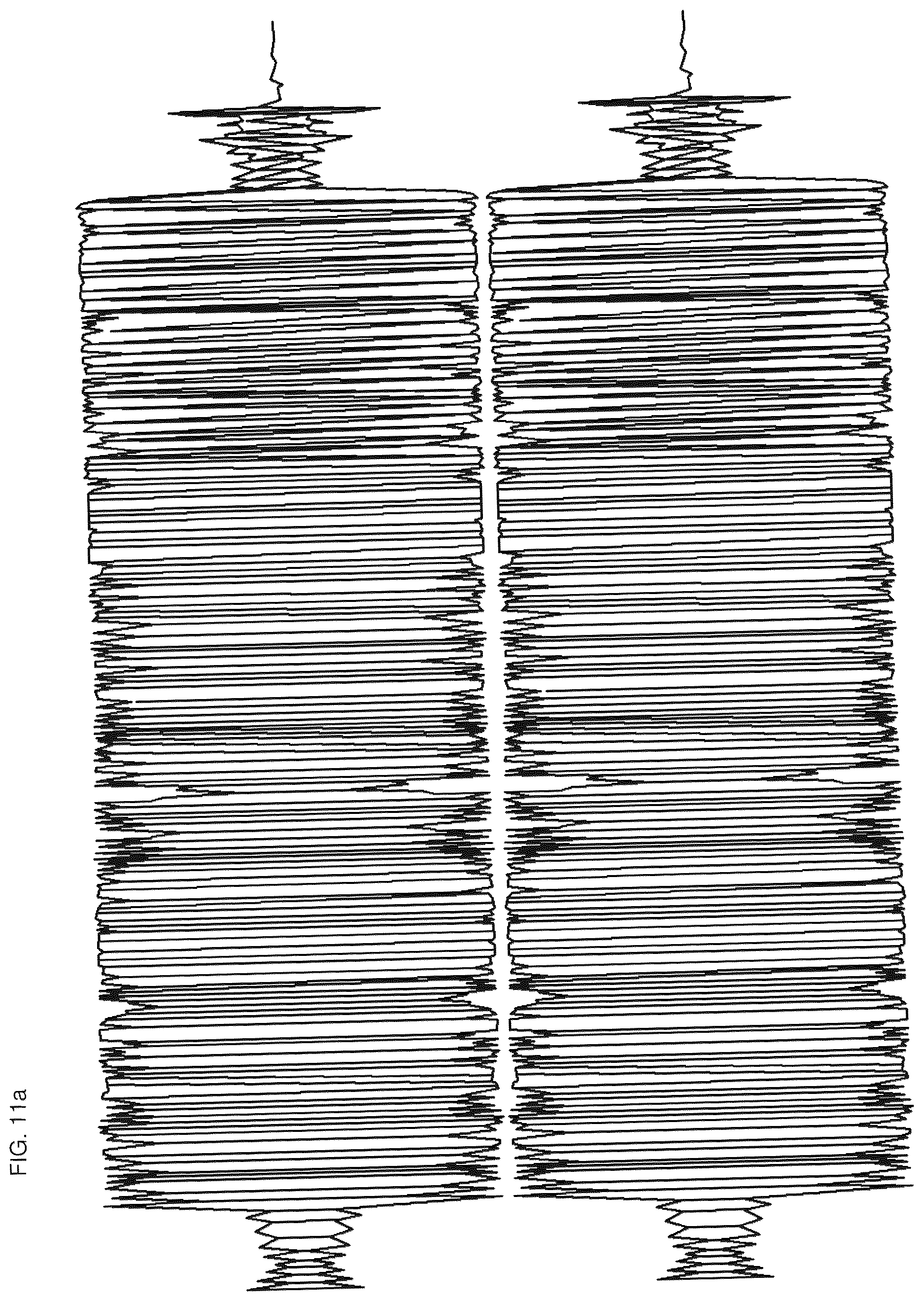 Patent US12619311 Figure 15 – Audio haptic output apparatus and home appliance including the same