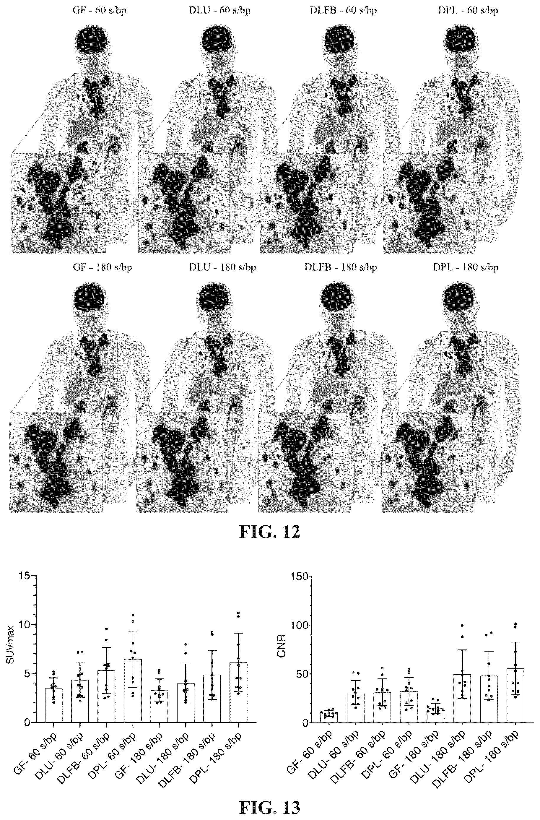 Patent US12619908 Figure 11 – System and method for medical imaging