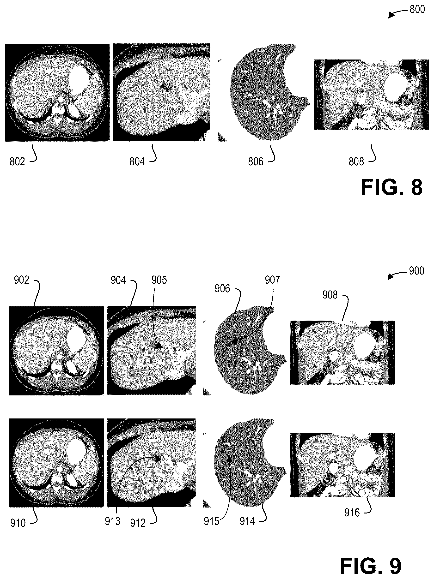 Patent US12620066 Figure 6 – Systems and methods for computed tomography image denoising with a bias-reducing loss function