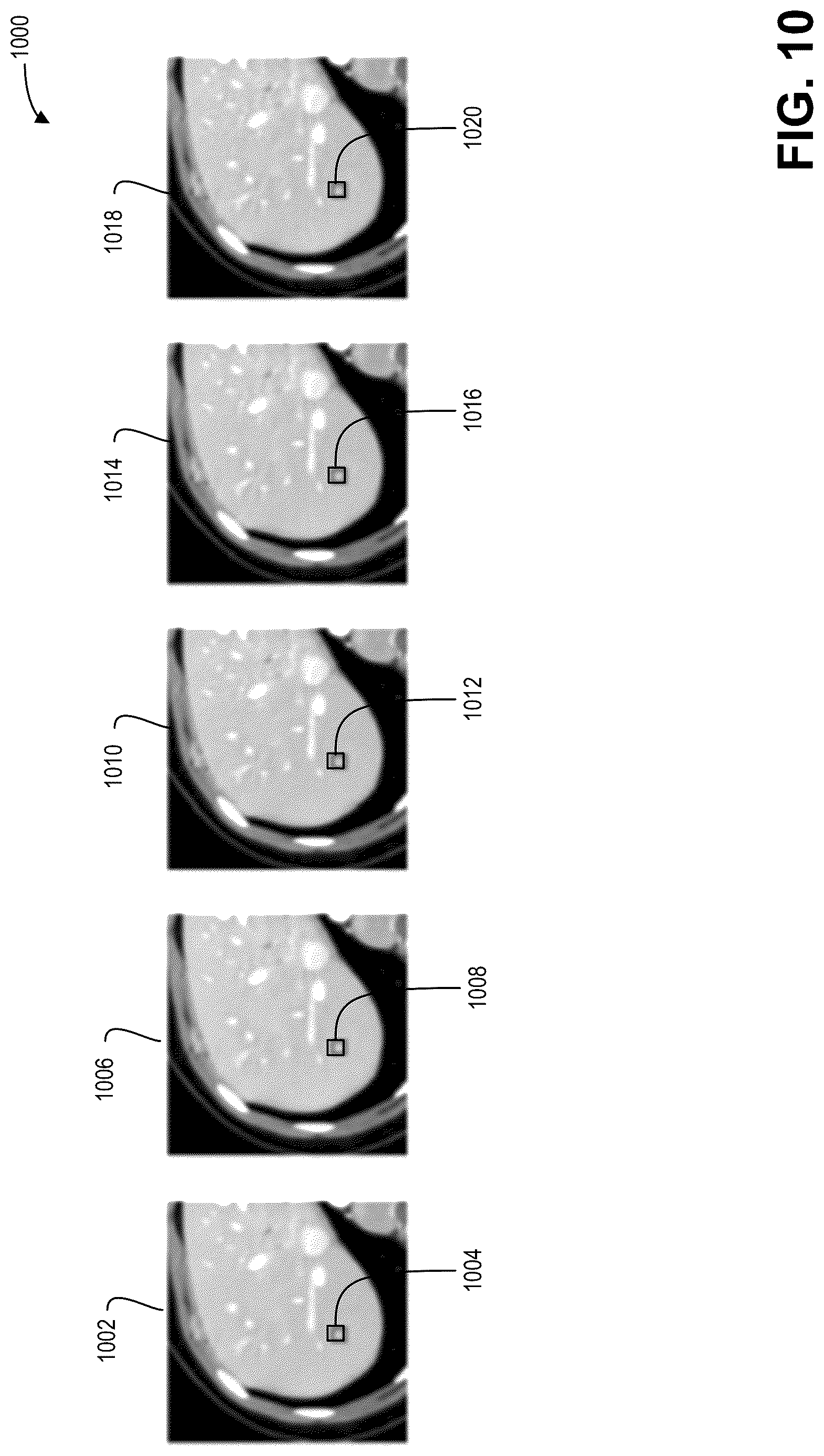 Patent US12620066 Figure 7 – Systems and methods for computed tomography image denoising with a bias-reducing loss function