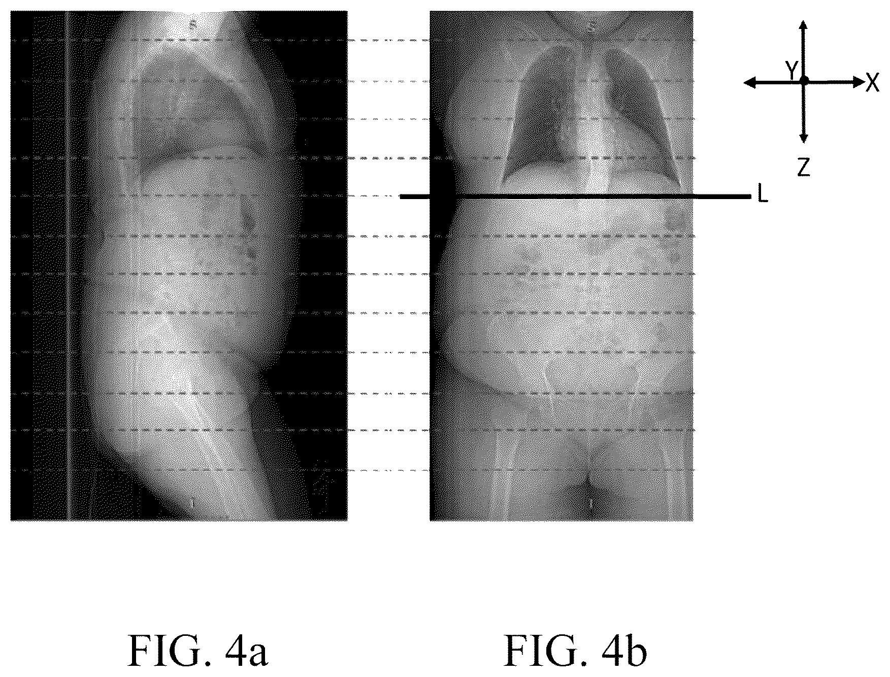 Patent US12620085 Figure 4 – Imaging system and method to estimate contour of a scanned object