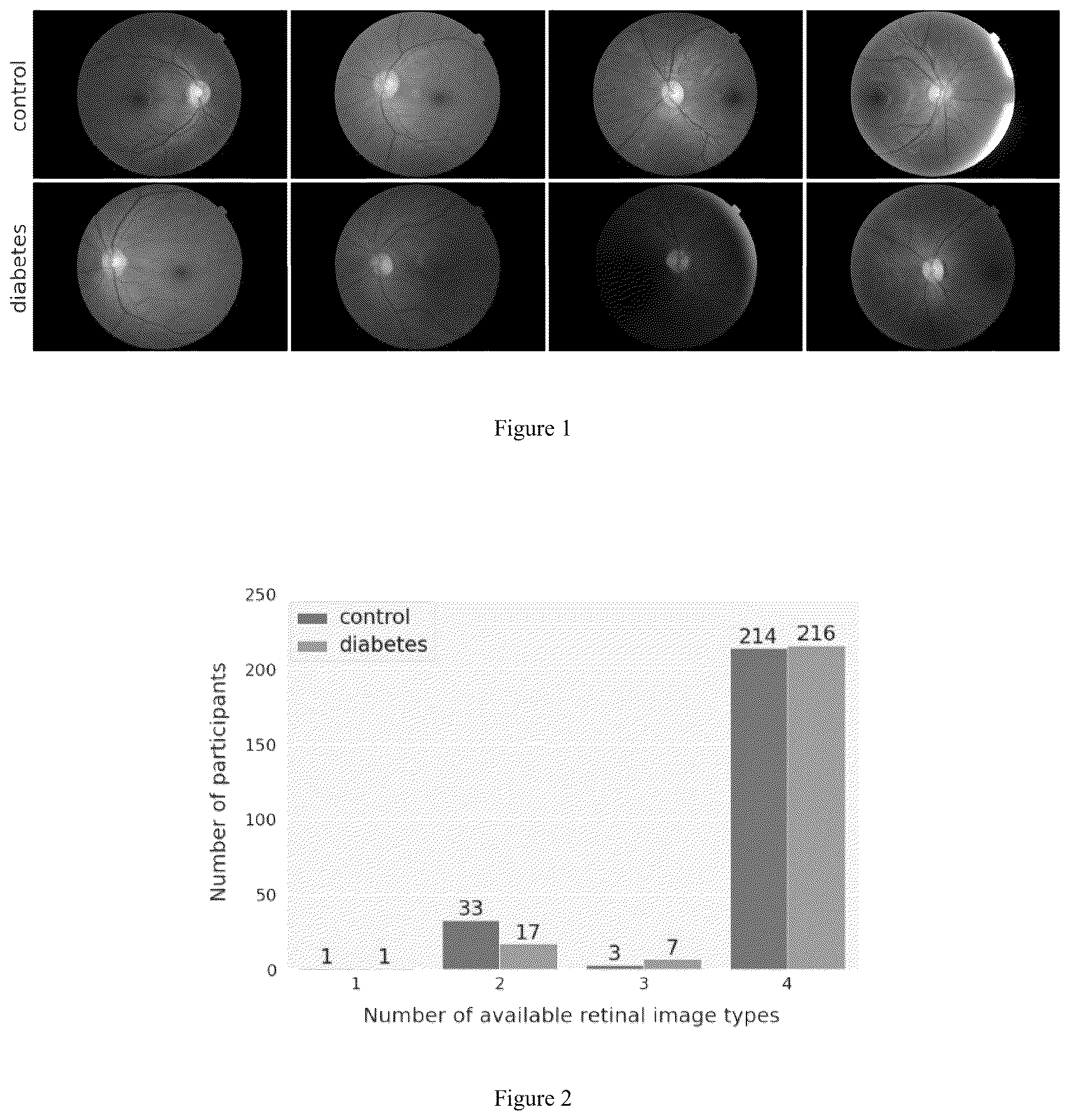 Patent US12620087 Figure 1 – Dianet: a deep learning based architecture to diagnose diabetes using retinal images only