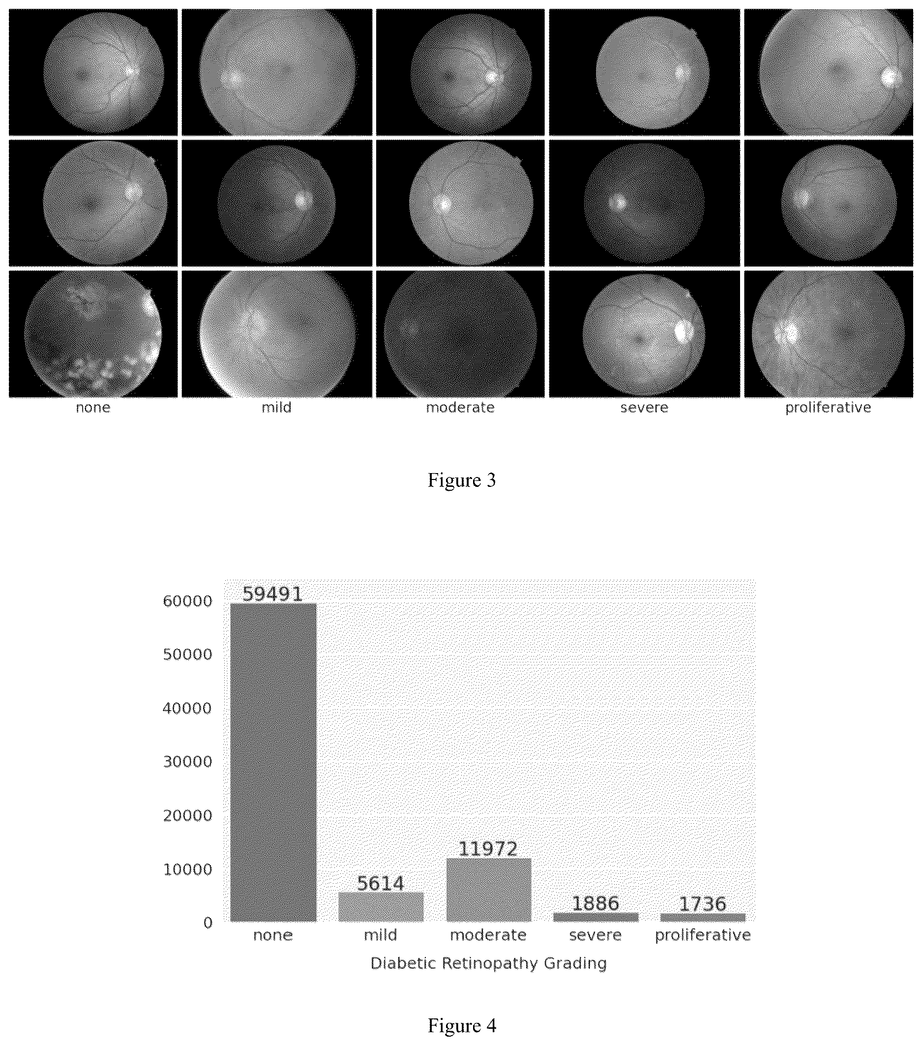 Patent US12620087 Figure 2 – Dianet: a deep learning based architecture to diagnose diabetes using retinal images only