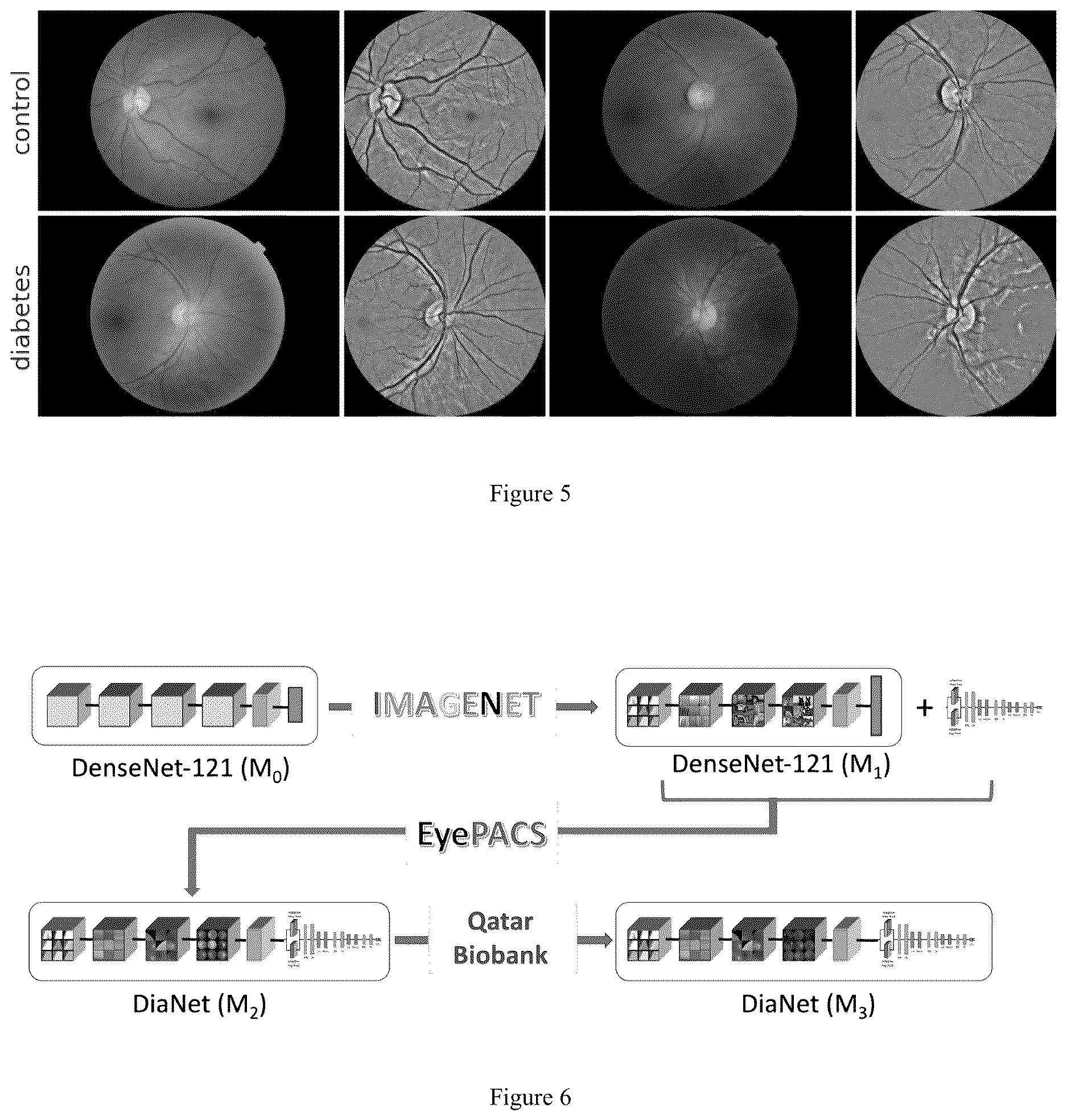 Patent US12620087 Figure 3 – Dianet: a deep learning based architecture to diagnose diabetes using retinal images only