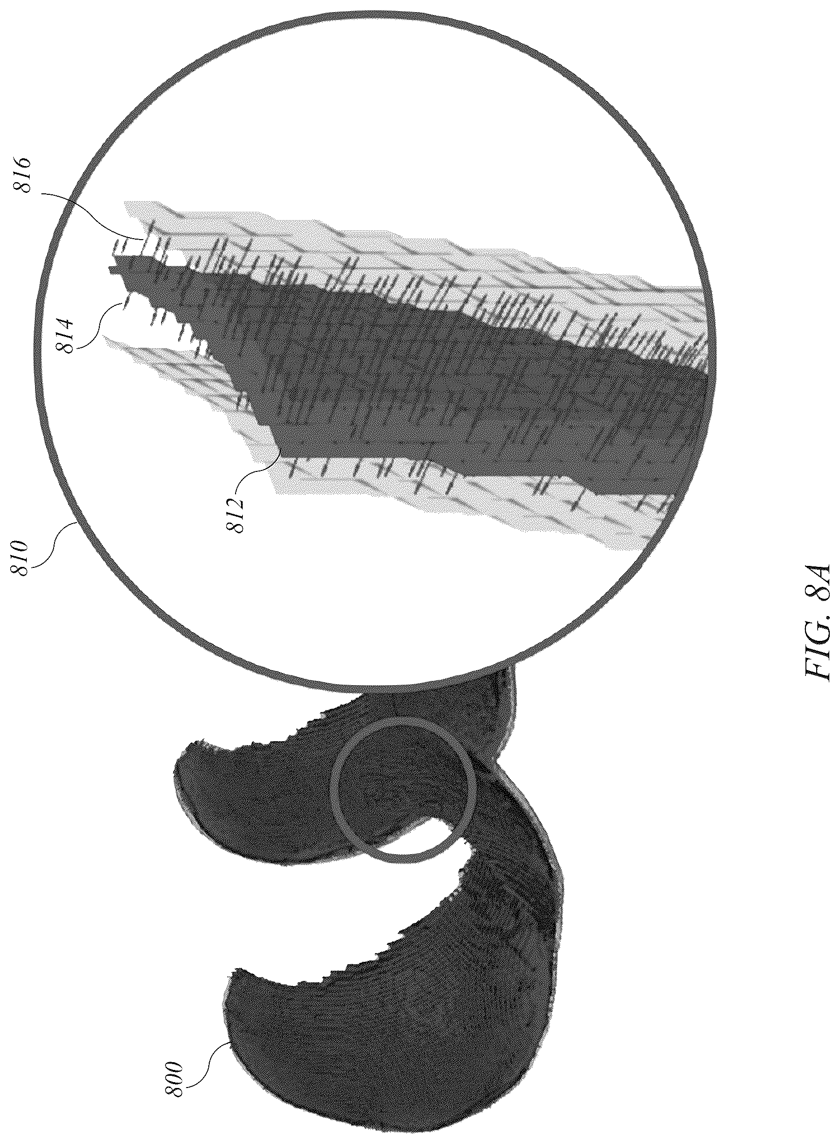 Patent US12620088 Figure 12 – System and method for articular cartilage thickness mapping and lesion quantification