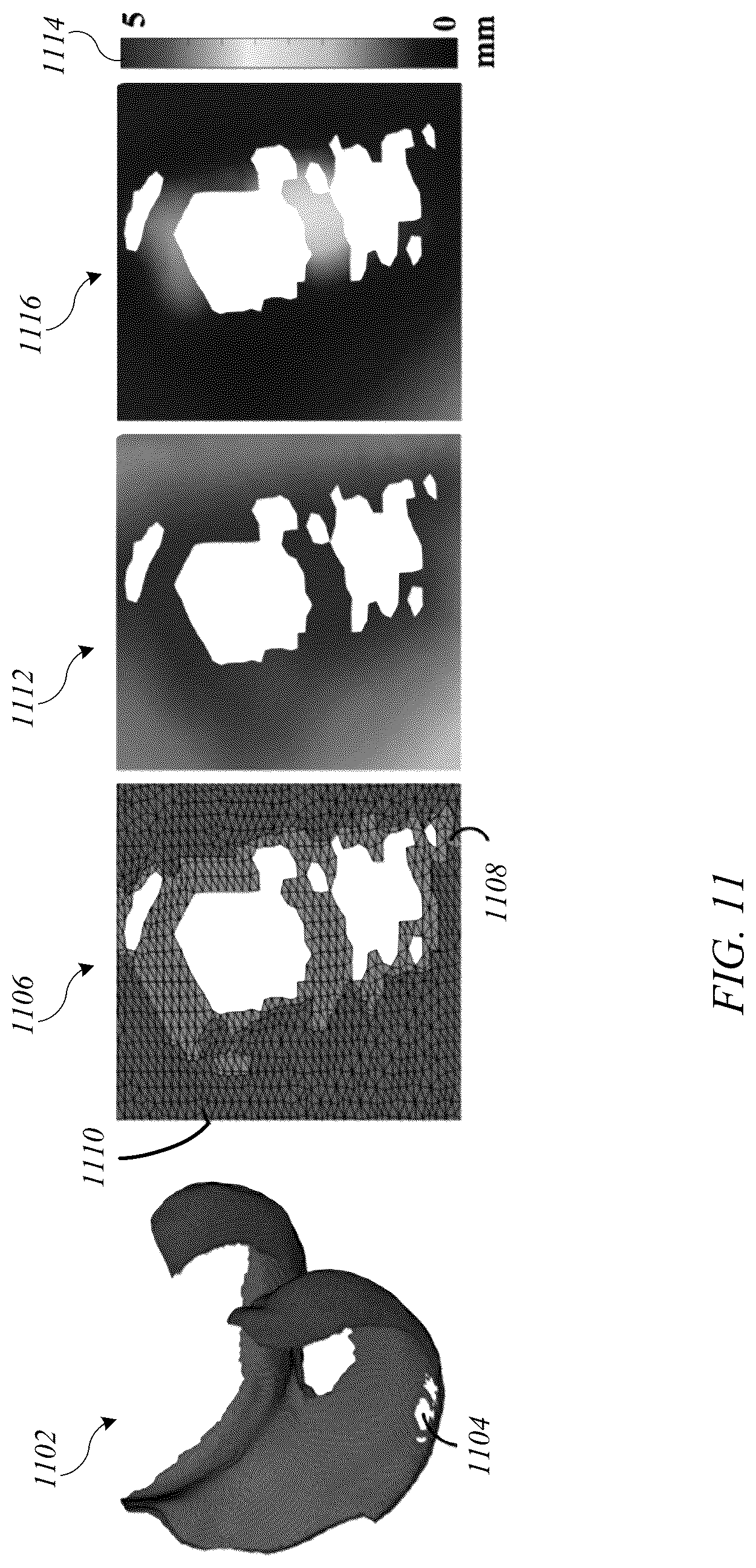 Patent US12620088 Figure 16 – System and method for articular cartilage thickness mapping and lesion quantification