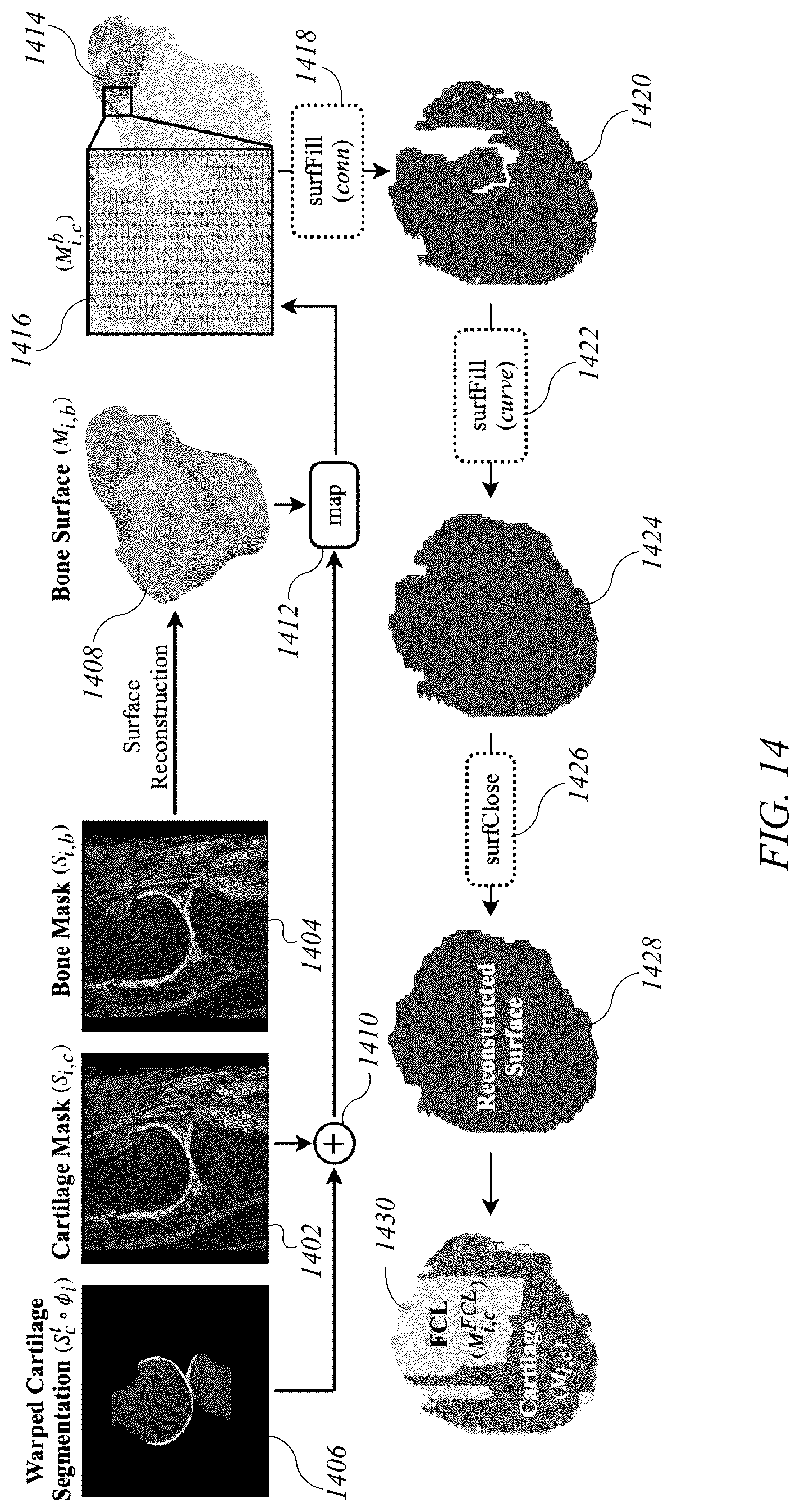 Patent US12620088 Figure 19 – System and method for articular cartilage thickness mapping and lesion quantification