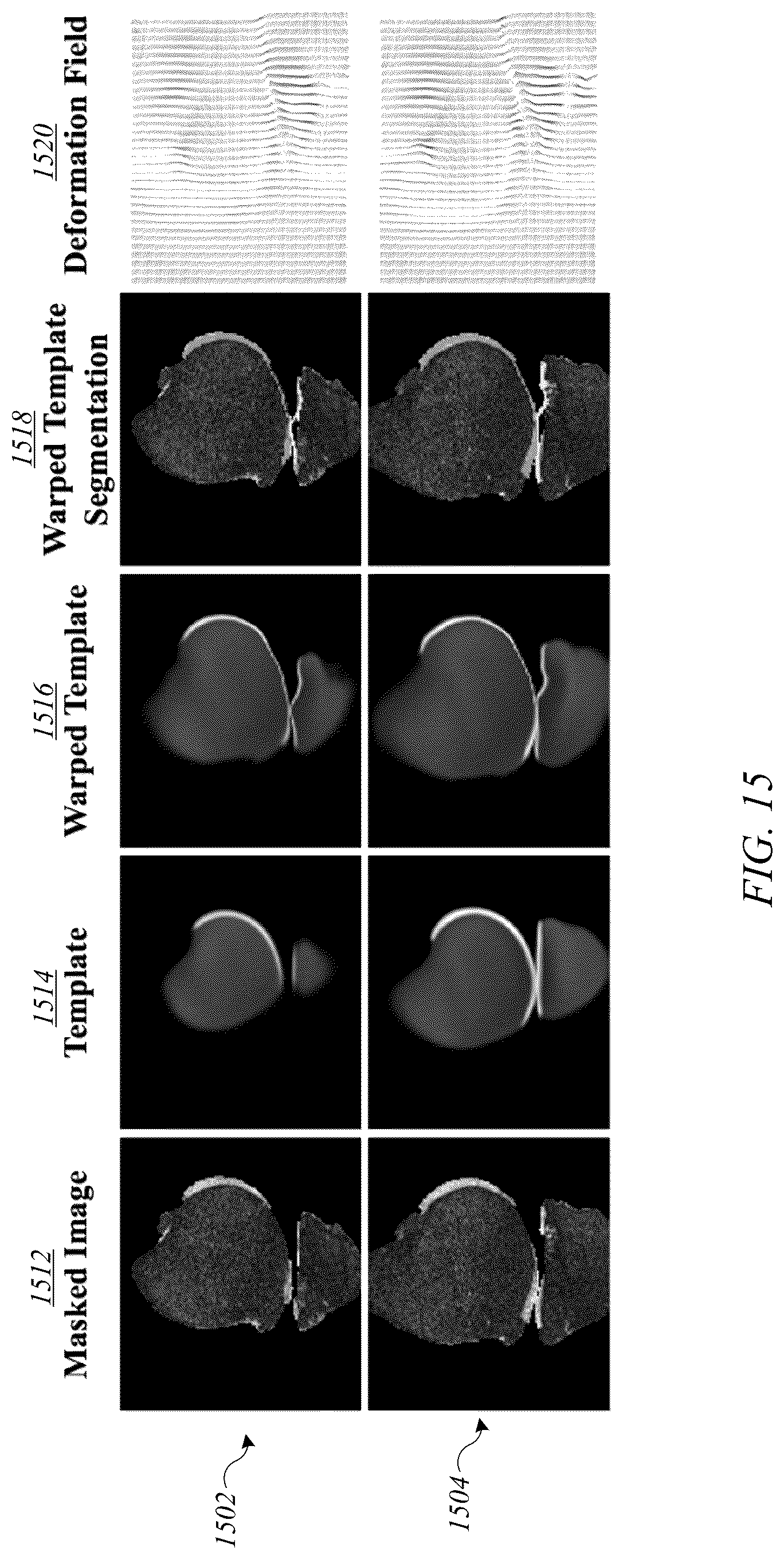 Patent US12620088 Figure 20 – System and method for articular cartilage thickness mapping and lesion quantification