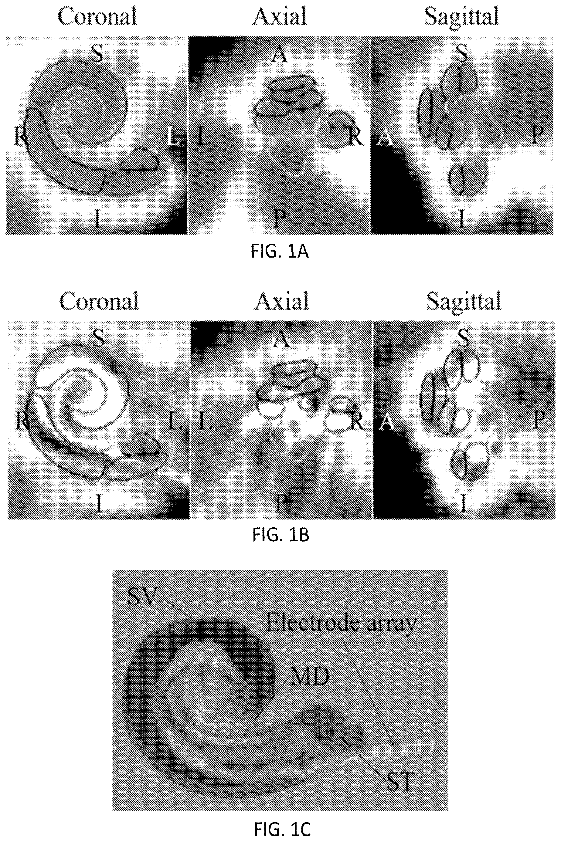 Patent US12620091 — Methods of automatic segmentation of anatomy in artifact affected CT images with deep neural networks and applications of same — Figure 1