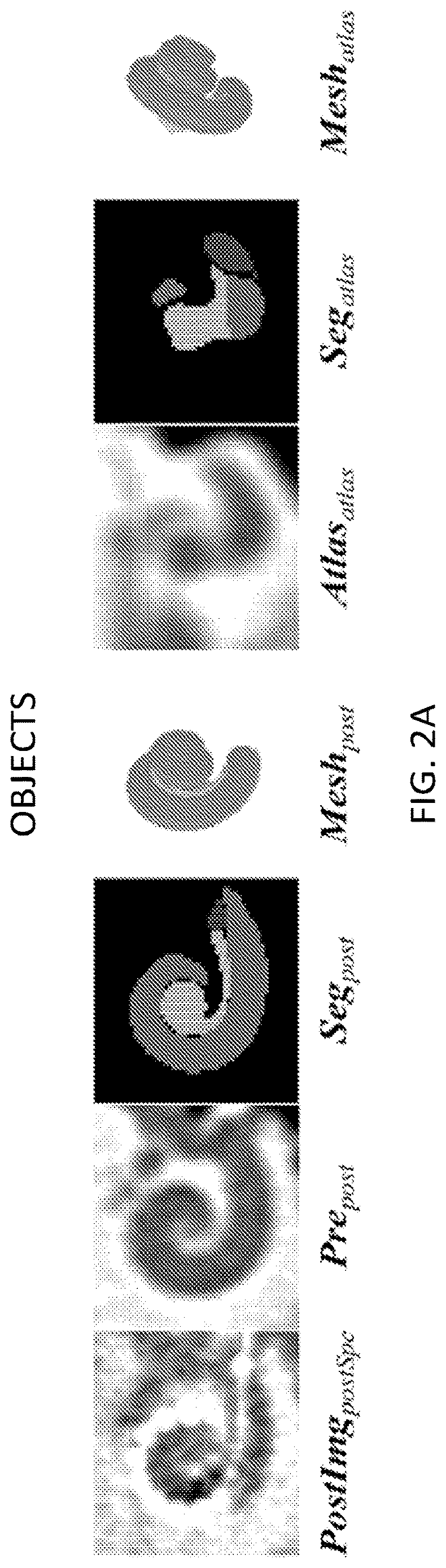 Patent US12620091 Figure 2 – Methods of automatic segmentation of anatomy in artifact affected CT images with deep neural networks and applications of same