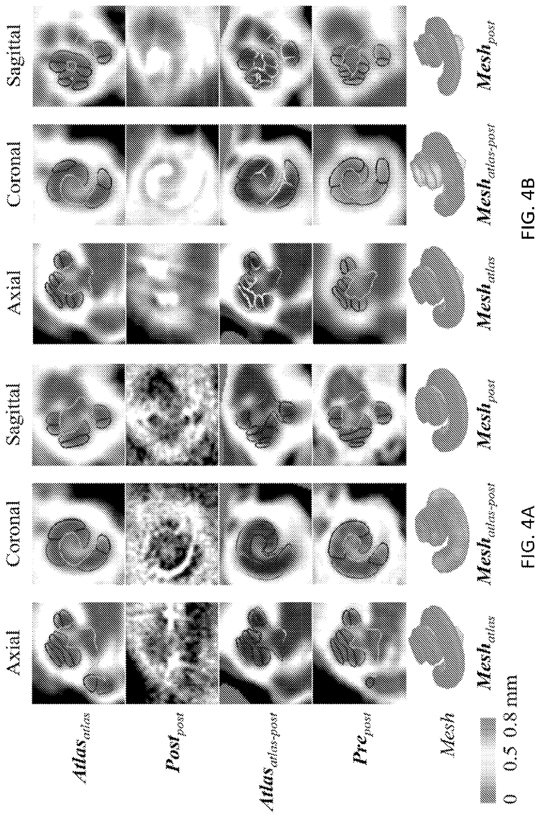 Patent US12620091 Figure 5 – Methods of automatic segmentation of anatomy in artifact affected CT images with deep neural networks and applications of same
