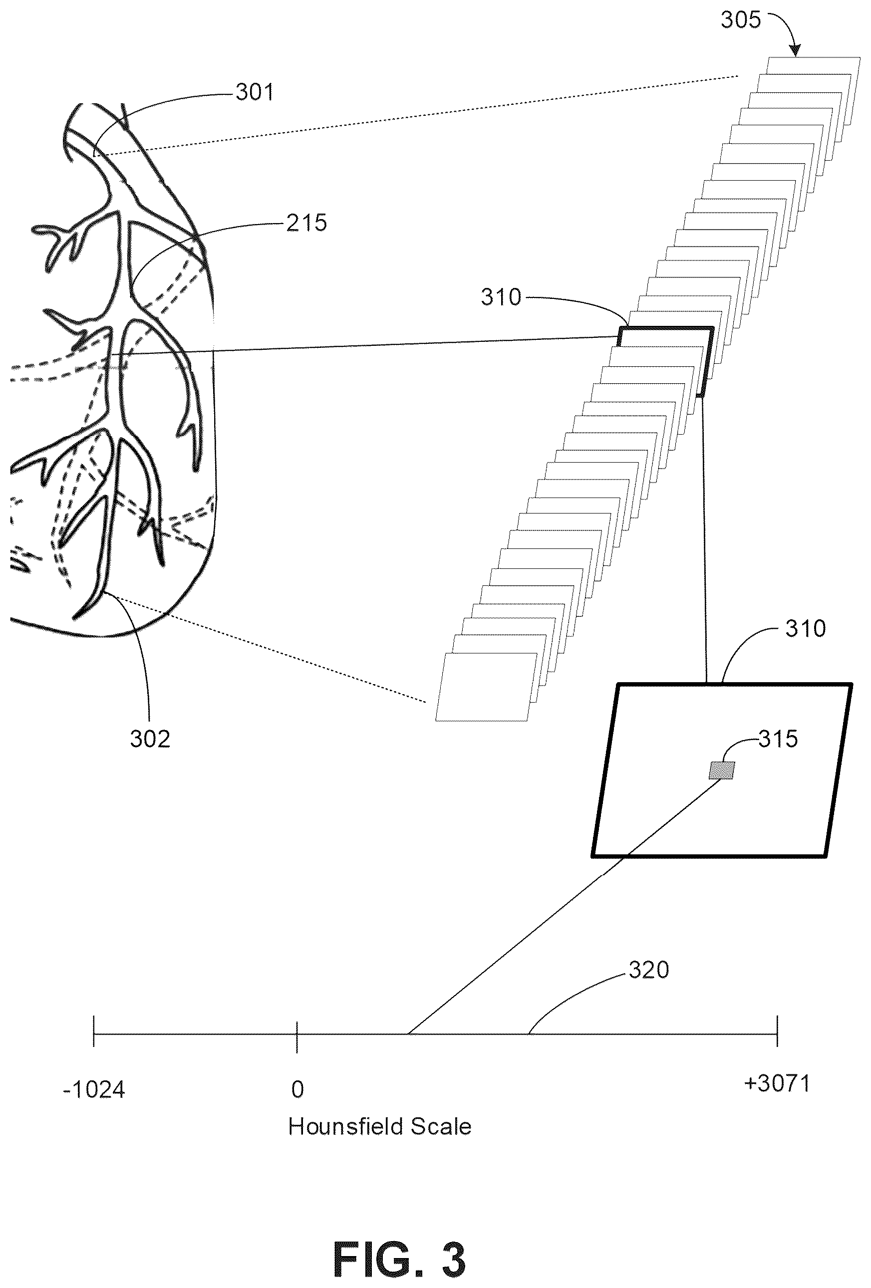 Patent US12620092 Figure 3 – Systems, devices, and methods for non-invasive image-based plaque analysis and risk determination