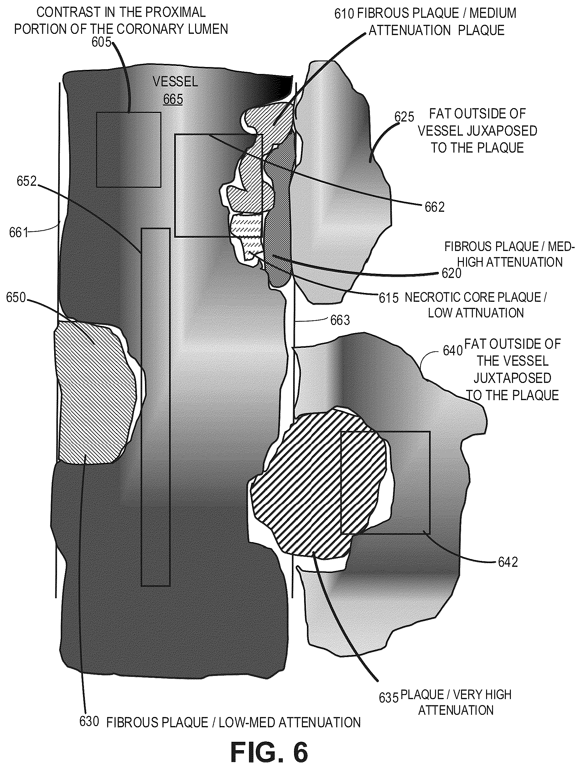 Patent US12620092 Figure 8 – Systems, devices, and methods for non-invasive image-based plaque analysis and risk determination