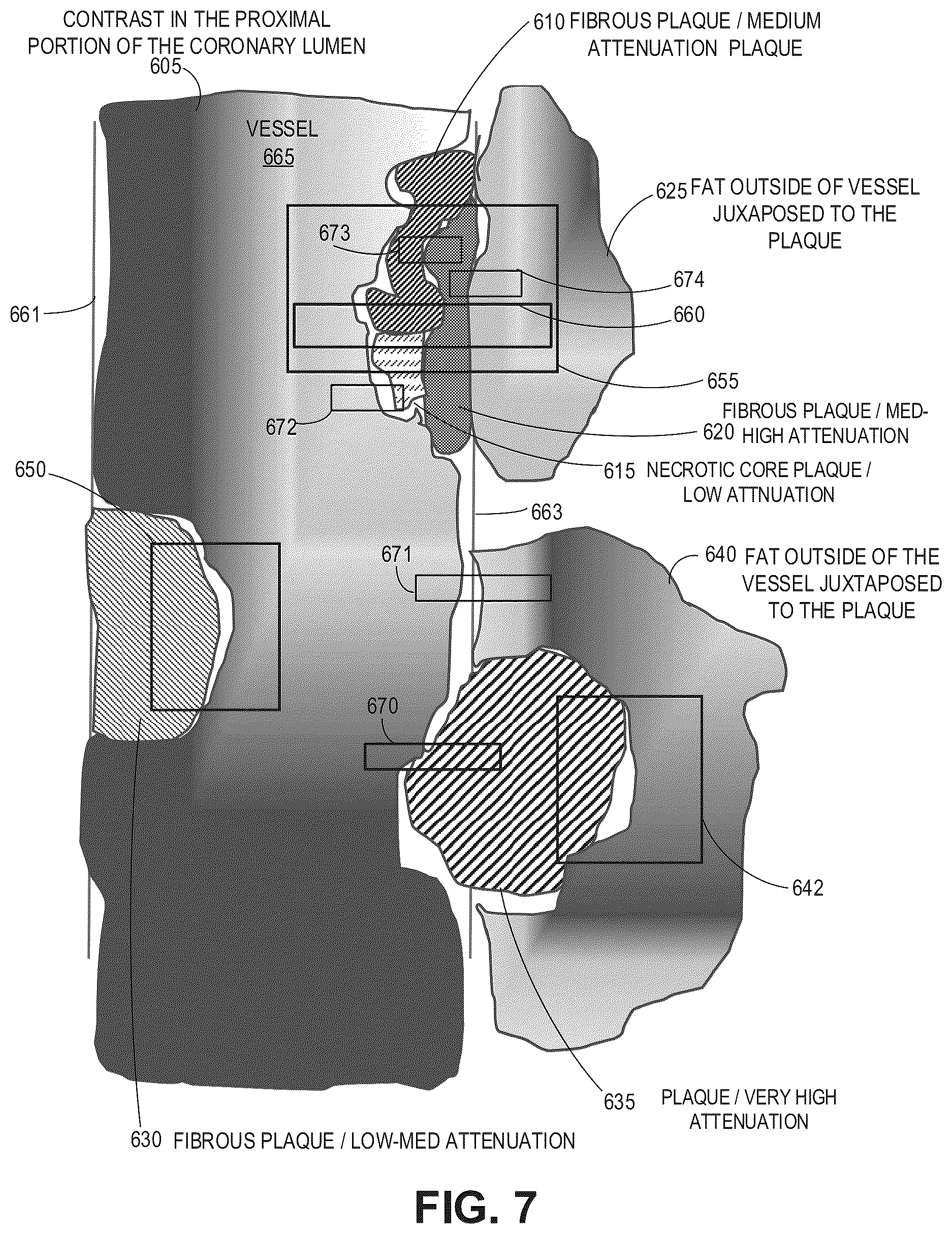 Patent US12620092 Figure 9 – Systems, devices, and methods for non-invasive image-based plaque analysis and risk determination