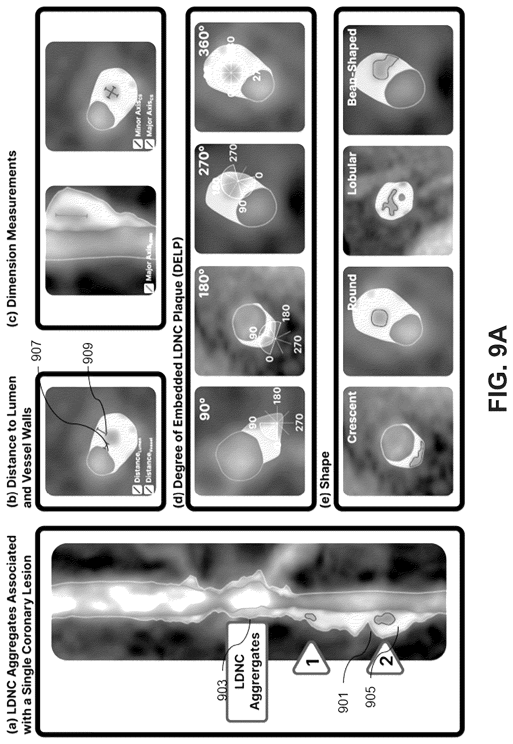 Patent US12620092 Figure 14 – Systems, devices, and methods for non-invasive image-based plaque analysis and risk determination