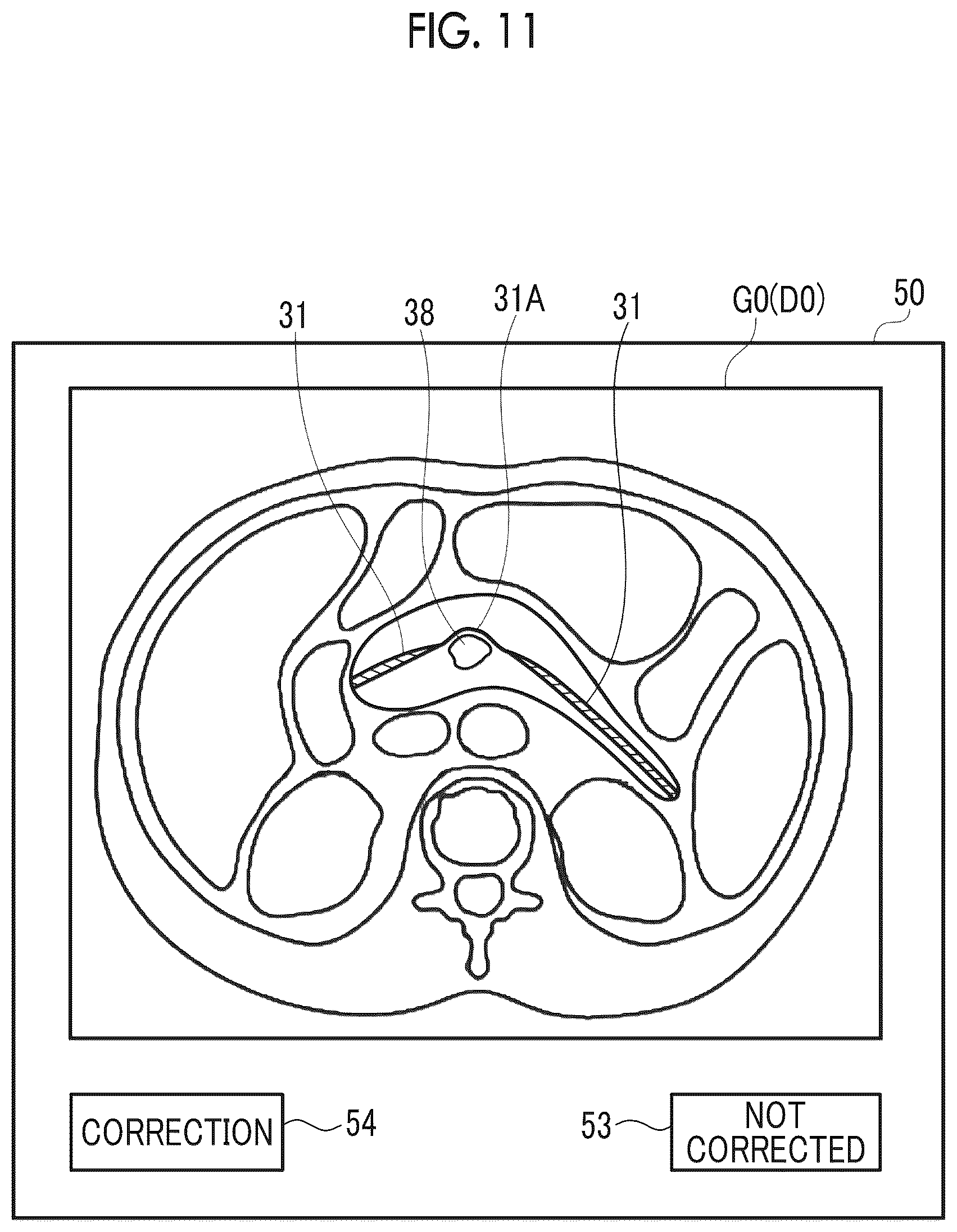 Patent US12620094 Figure 6 – Image processing apparatus, image processing method, and image processing program