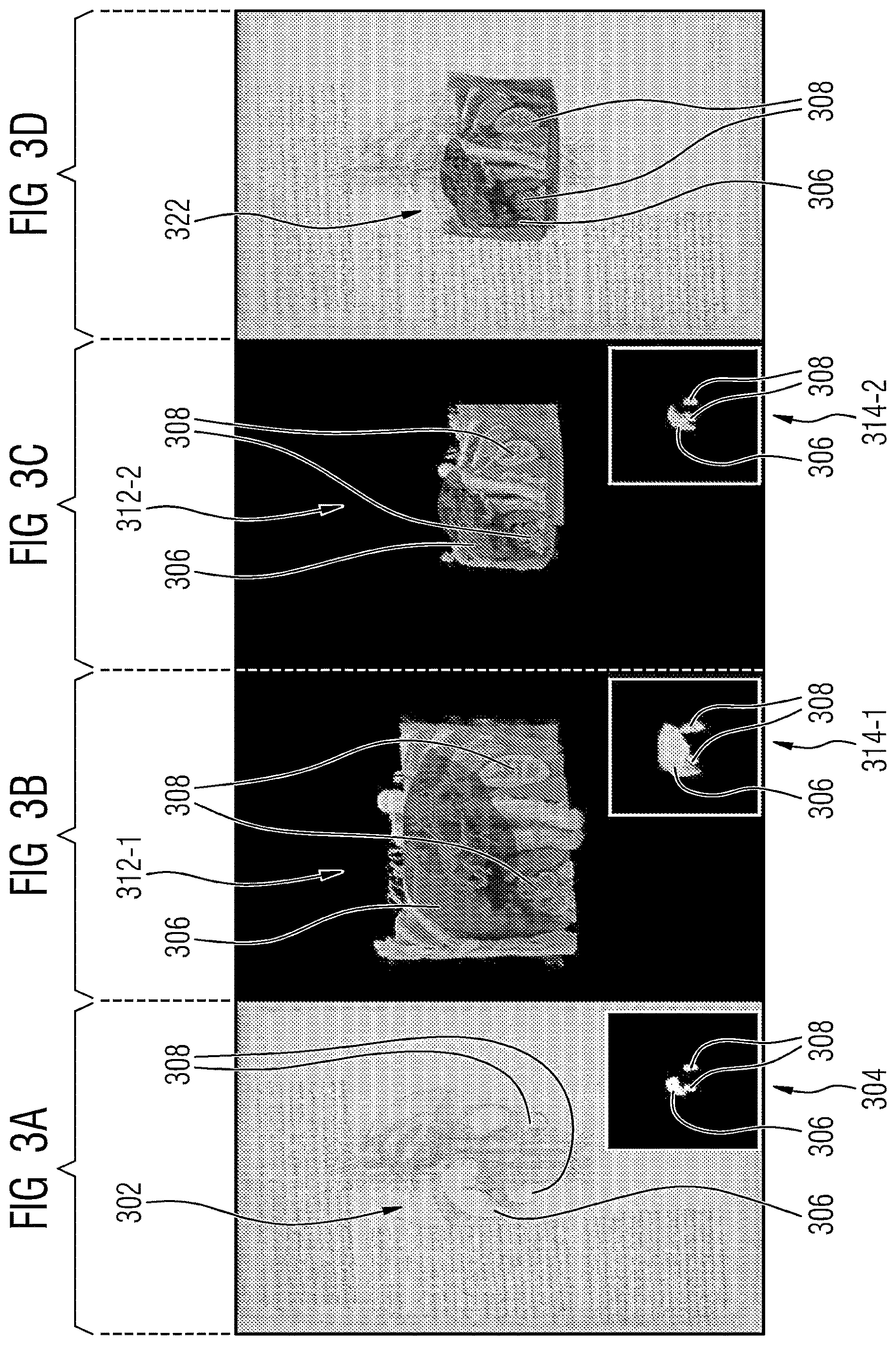 Patent US12620097 Figure 2 – Technique for optimizing rendering parameters of overlays of medical images