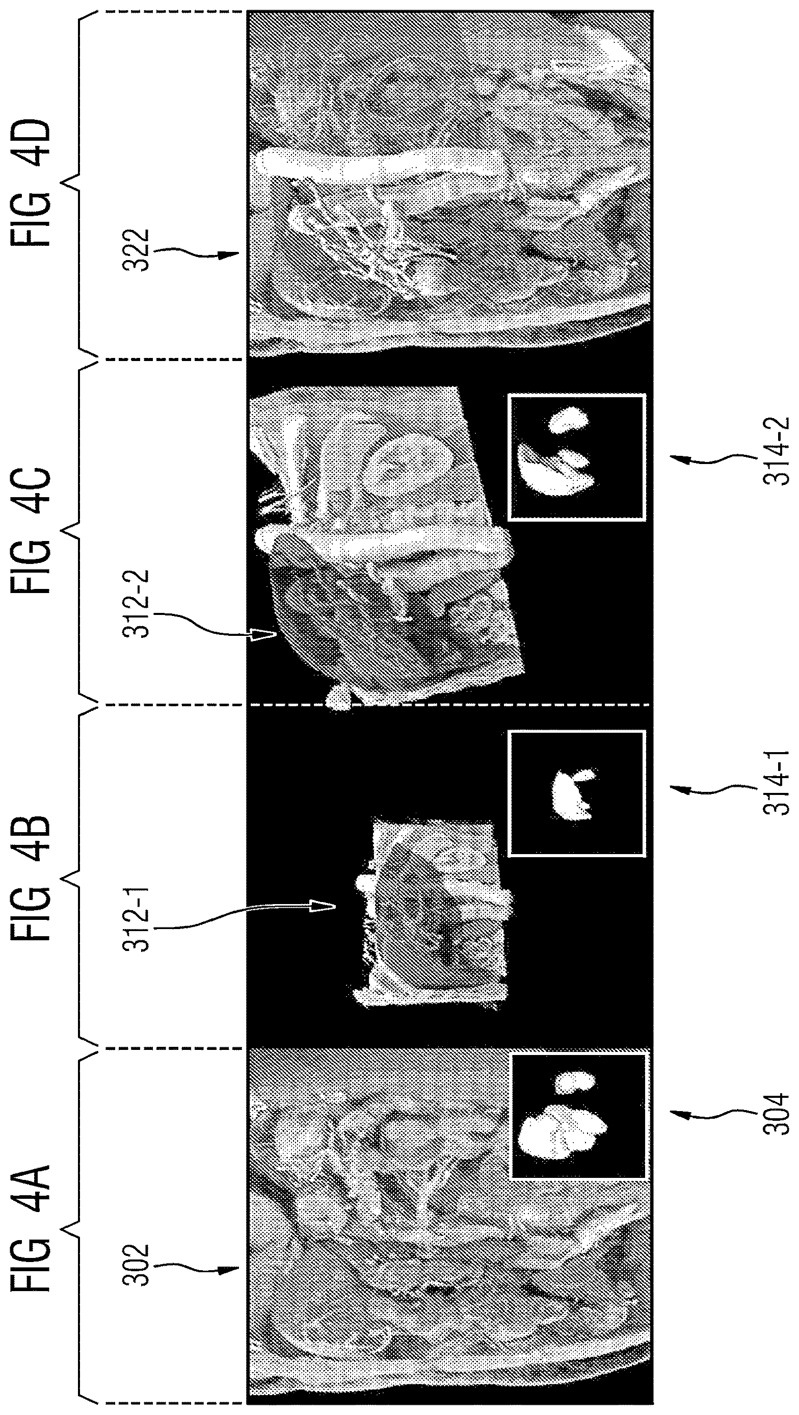 Patent US12620097 Figure 3 – Technique for optimizing rendering parameters of overlays of medical images