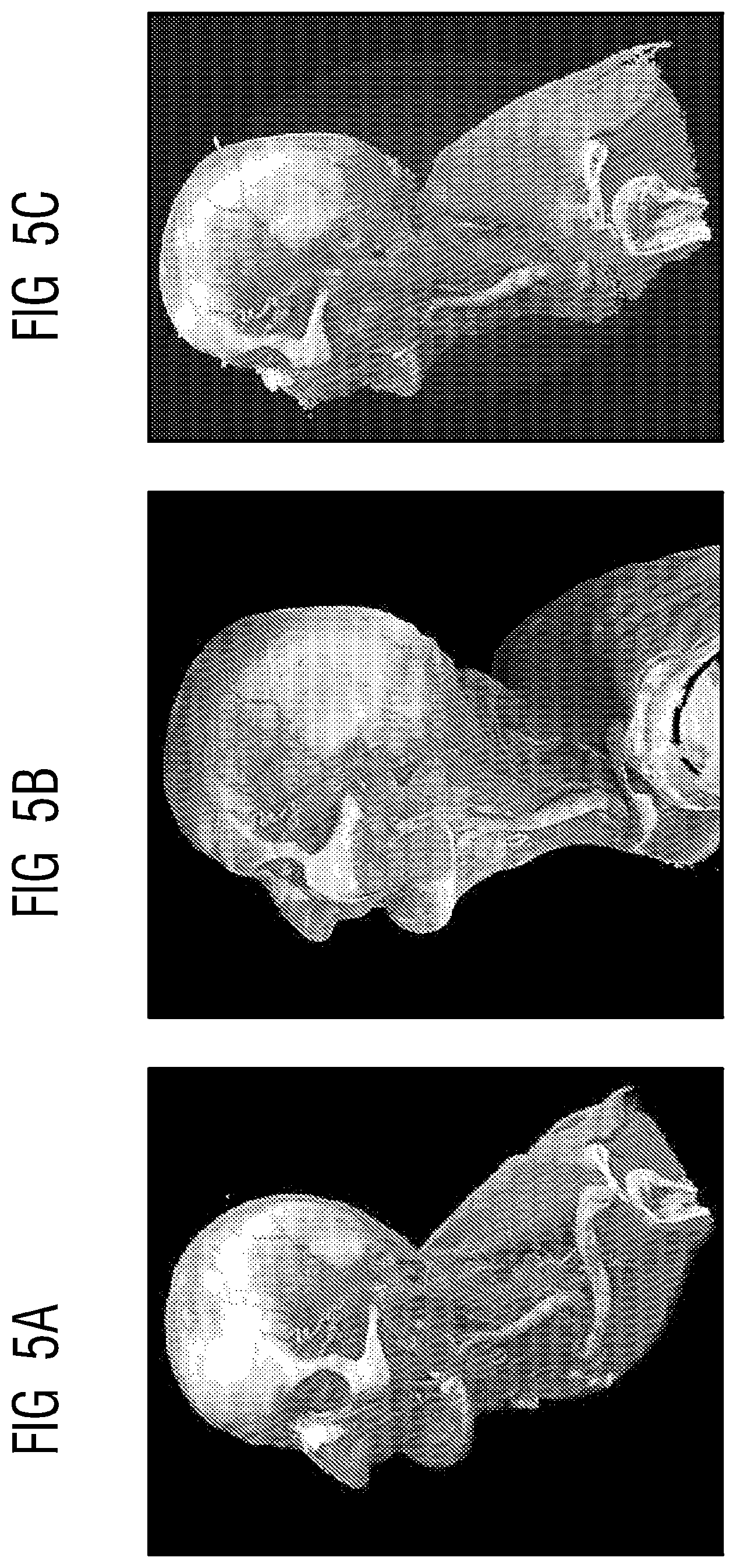 Patent US12620097 Figure 4 – Technique for optimizing rendering parameters of overlays of medical images