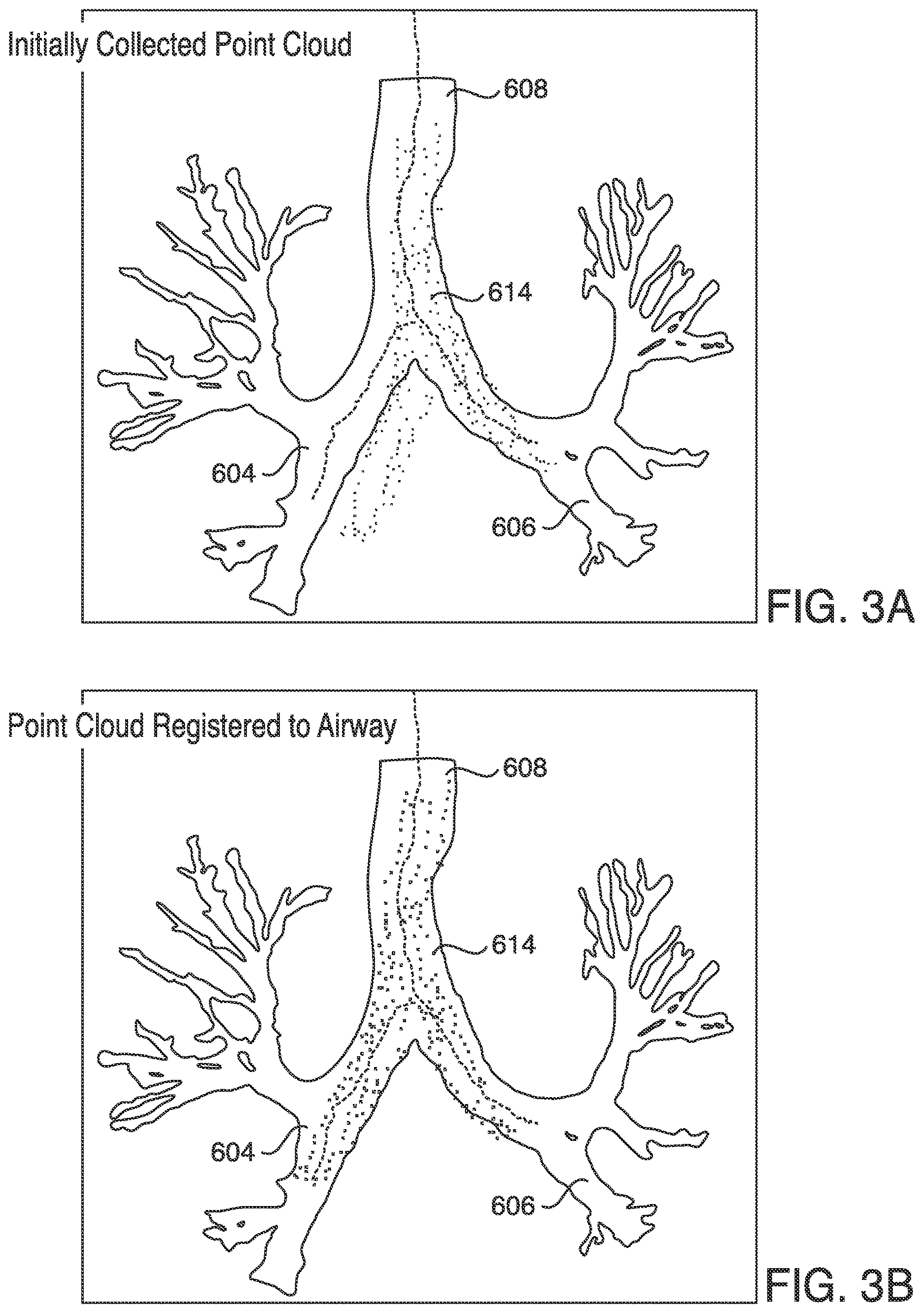 Patent US12620101 Figure 3 – Systems, methods and devices for forming respiratory-gated point cloud for four dimensional soft tissue navigation