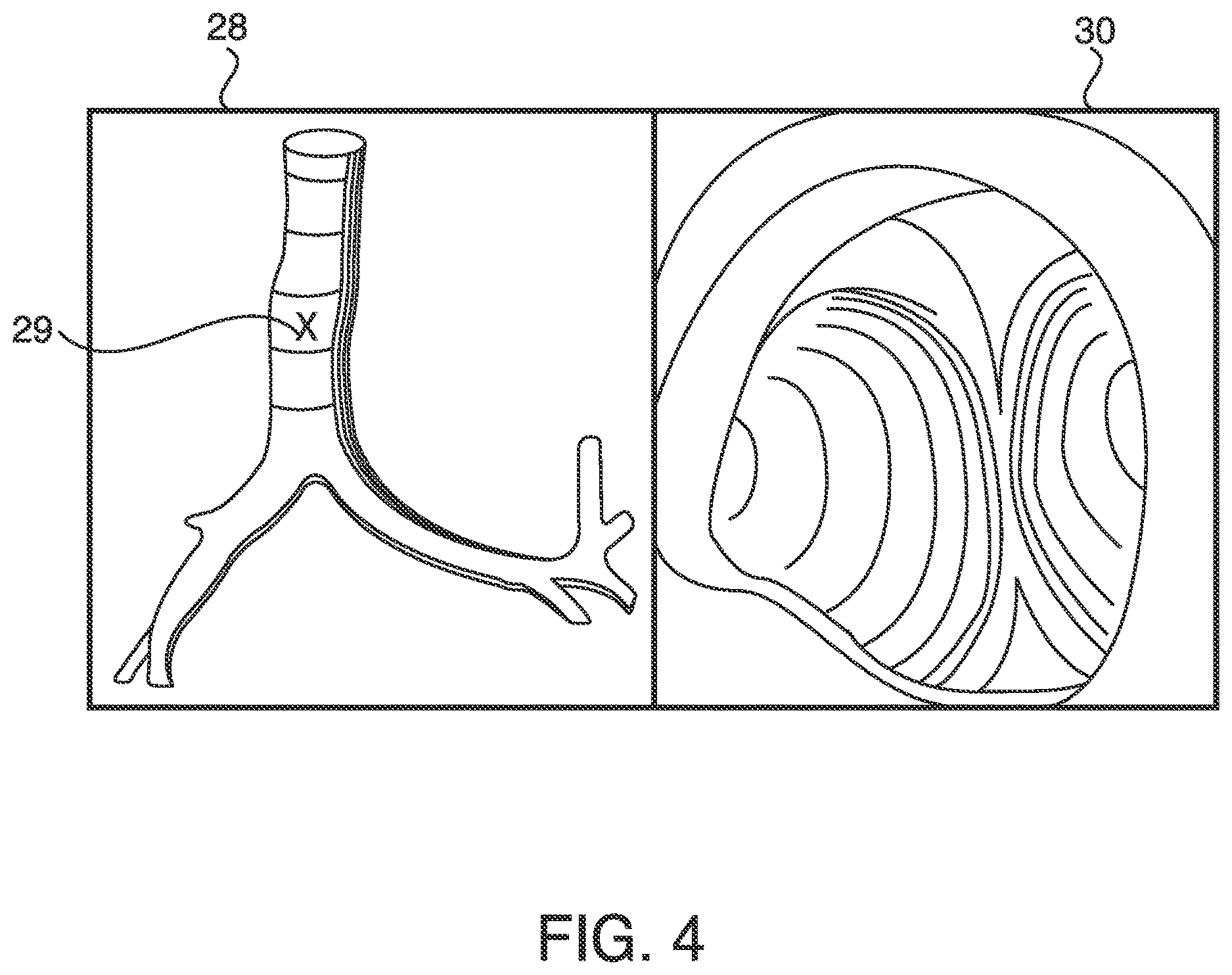 Patent US12620101 Figure 4 – Systems, methods and devices for forming respiratory-gated point cloud for four dimensional soft tissue navigation