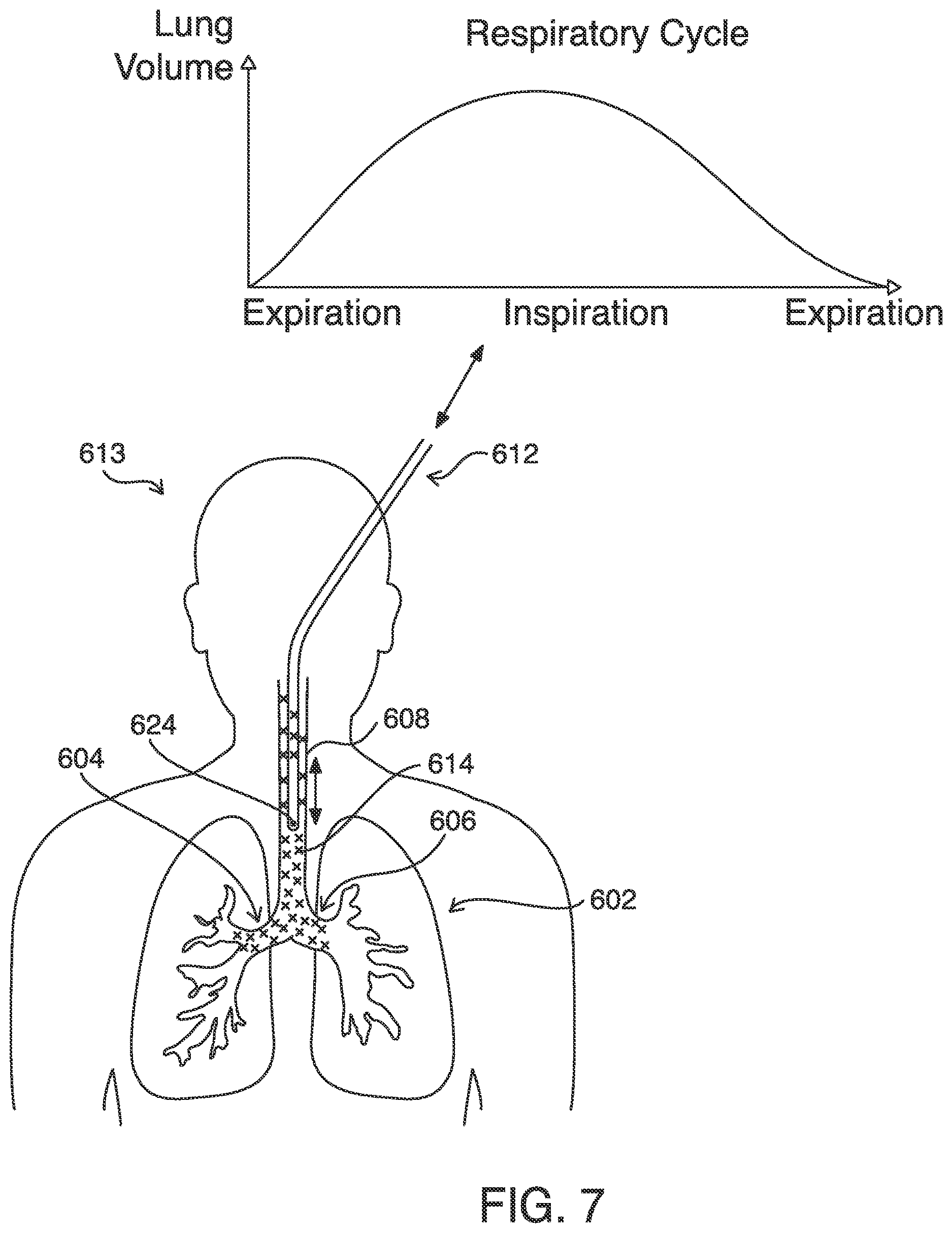 Patent US12620101 Figure 7 – Systems, methods and devices for forming respiratory-gated point cloud for four dimensional soft tissue navigation