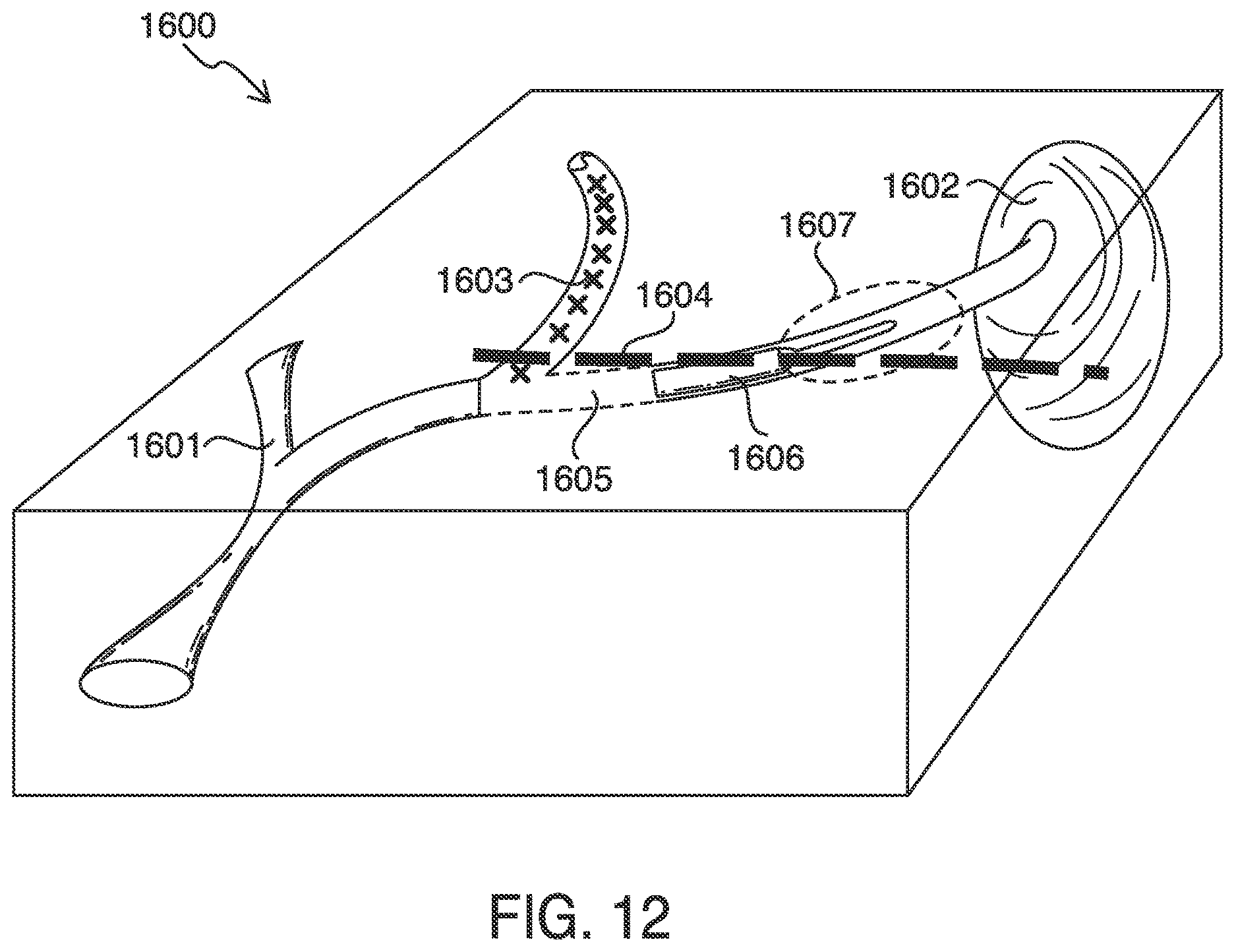 Patent US12620101 Figure 12 – Systems, methods and devices for forming respiratory-gated point cloud for four dimensional soft tissue navigation