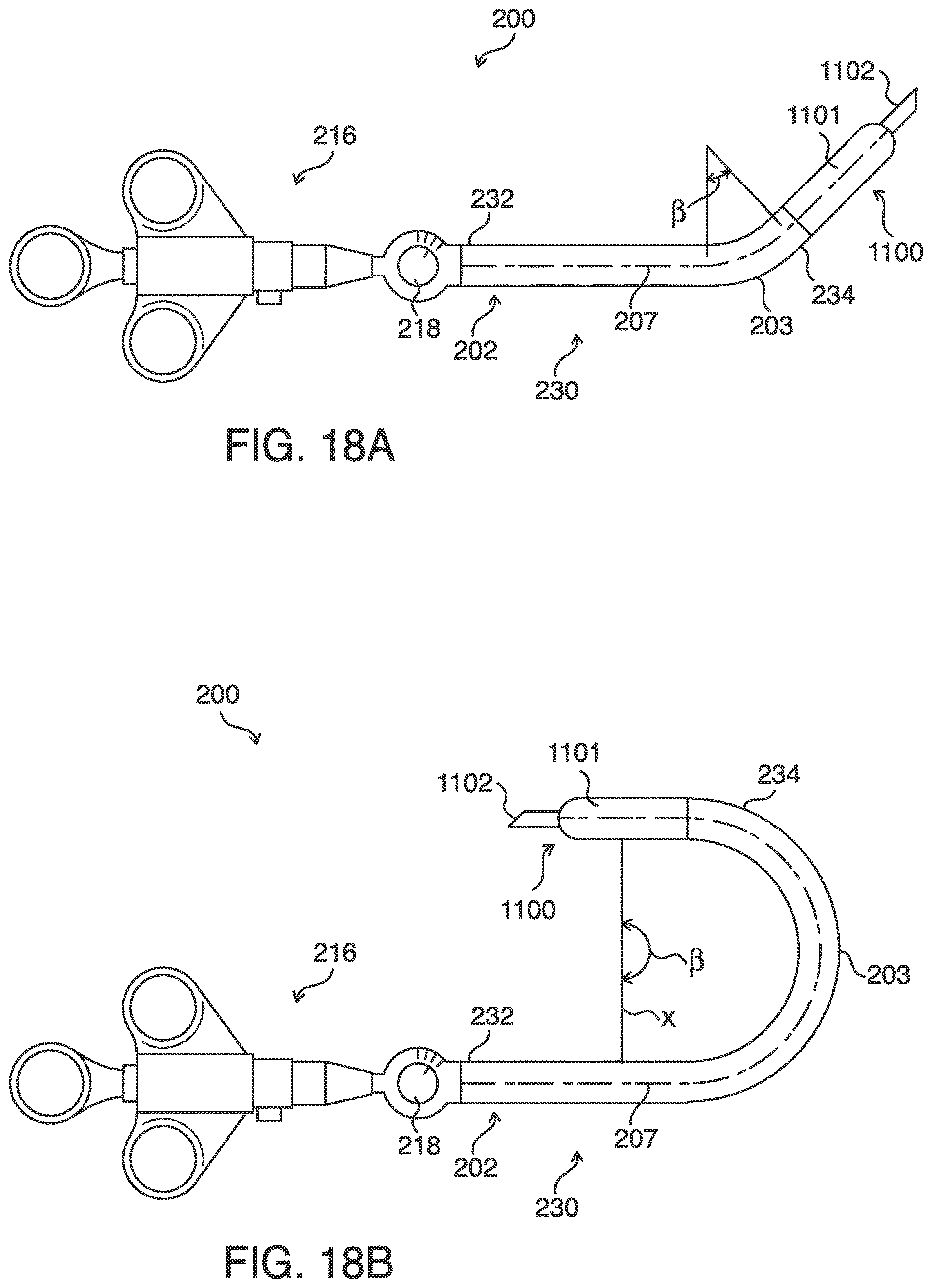 Patent US12620101 Figure 18 – Systems, methods and devices for forming respiratory-gated point cloud for four dimensional soft tissue navigation