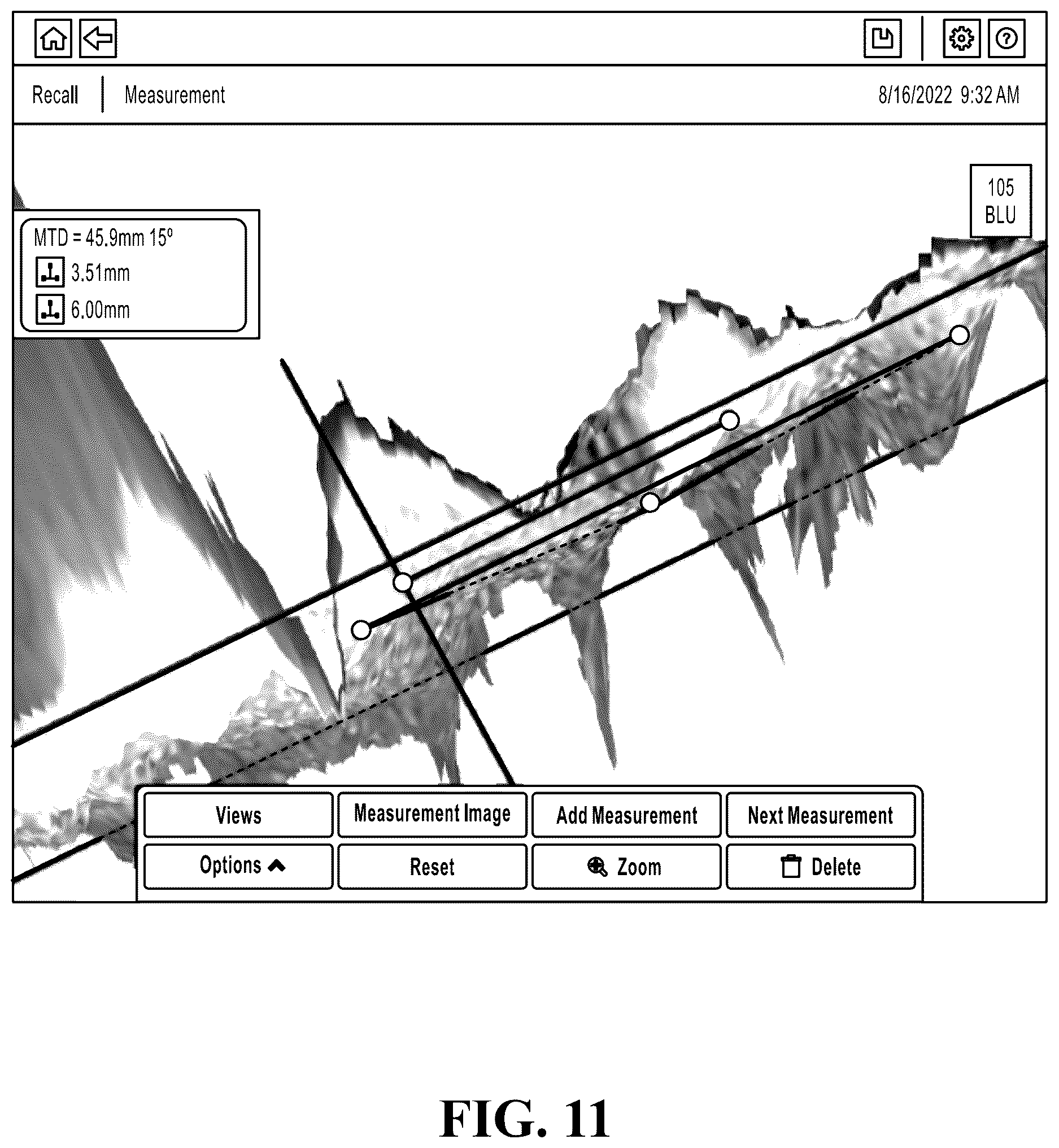 Patent US12620102 Figure 11 – Measuring a feature near the edge of an object