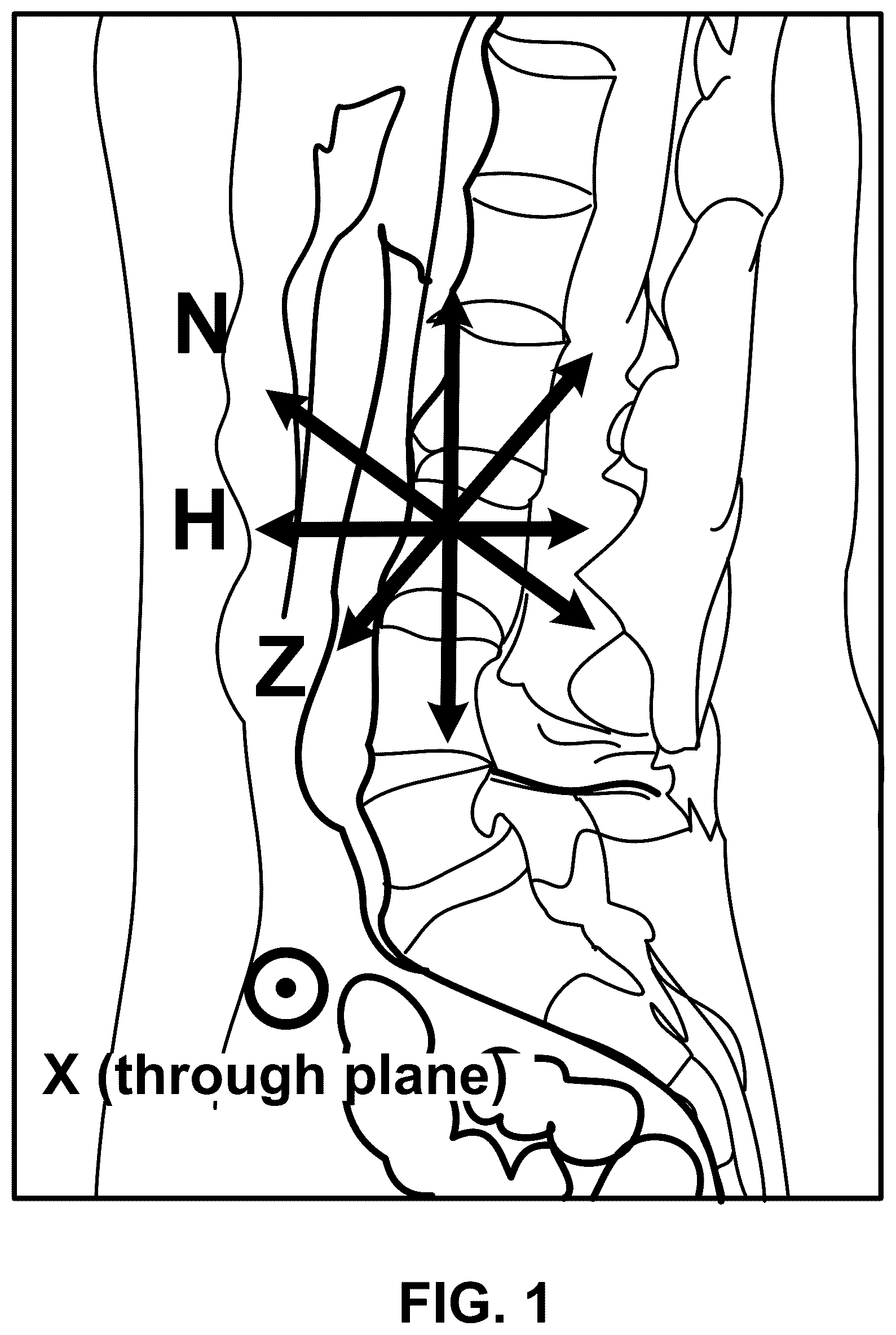 Patent US12620106 Figure 1 – MRI-based textural analysis of trabecular bone