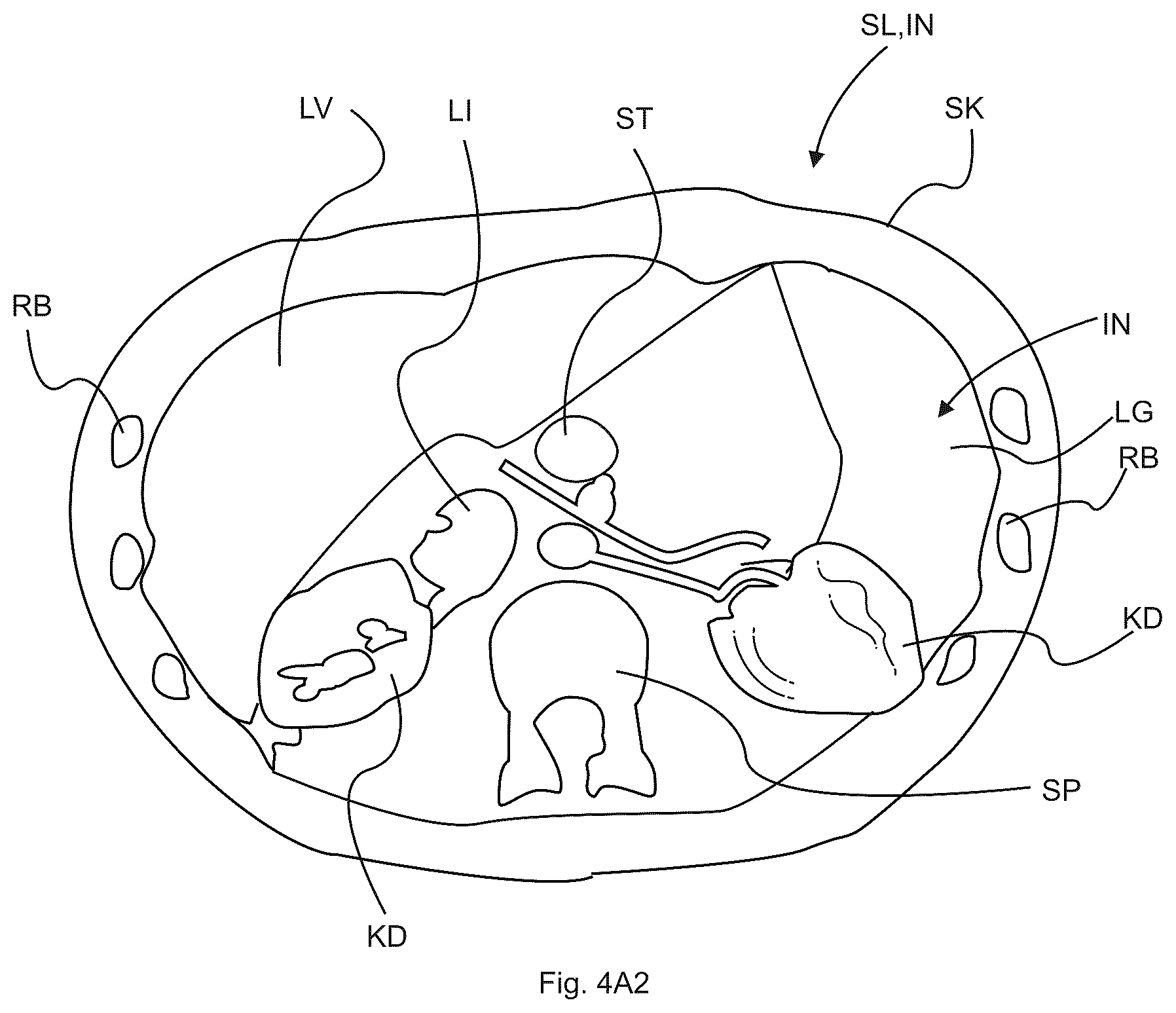 Patent US12620112 Figure 5 – Subsurface imaging and display of 3D digital image and 3D image sequence